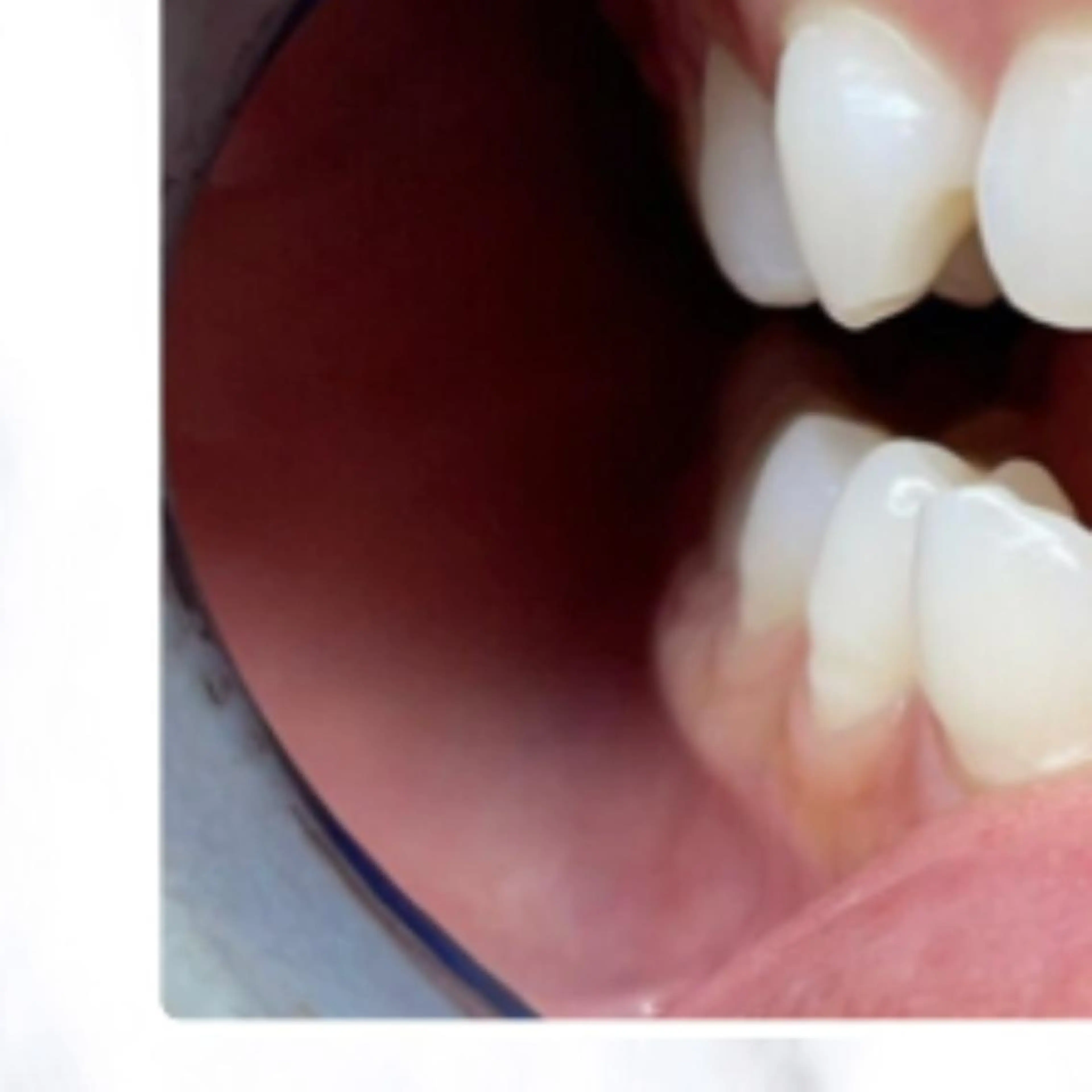 その他 ライトケアサロン 渋谷店② 渡邊のその他イメージ