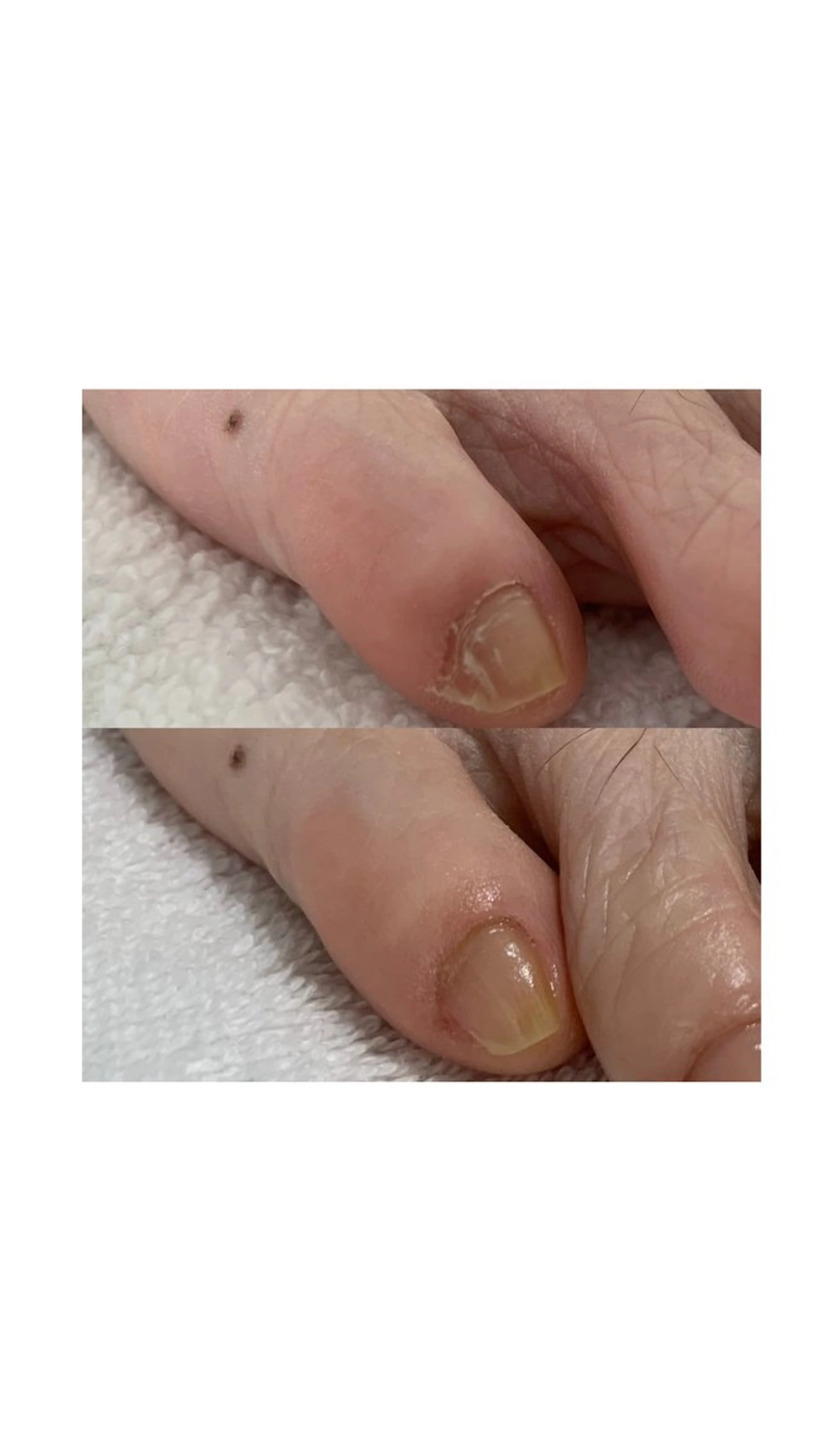 ネイル Alo.nail アロ•ネイルのネイルデザイン