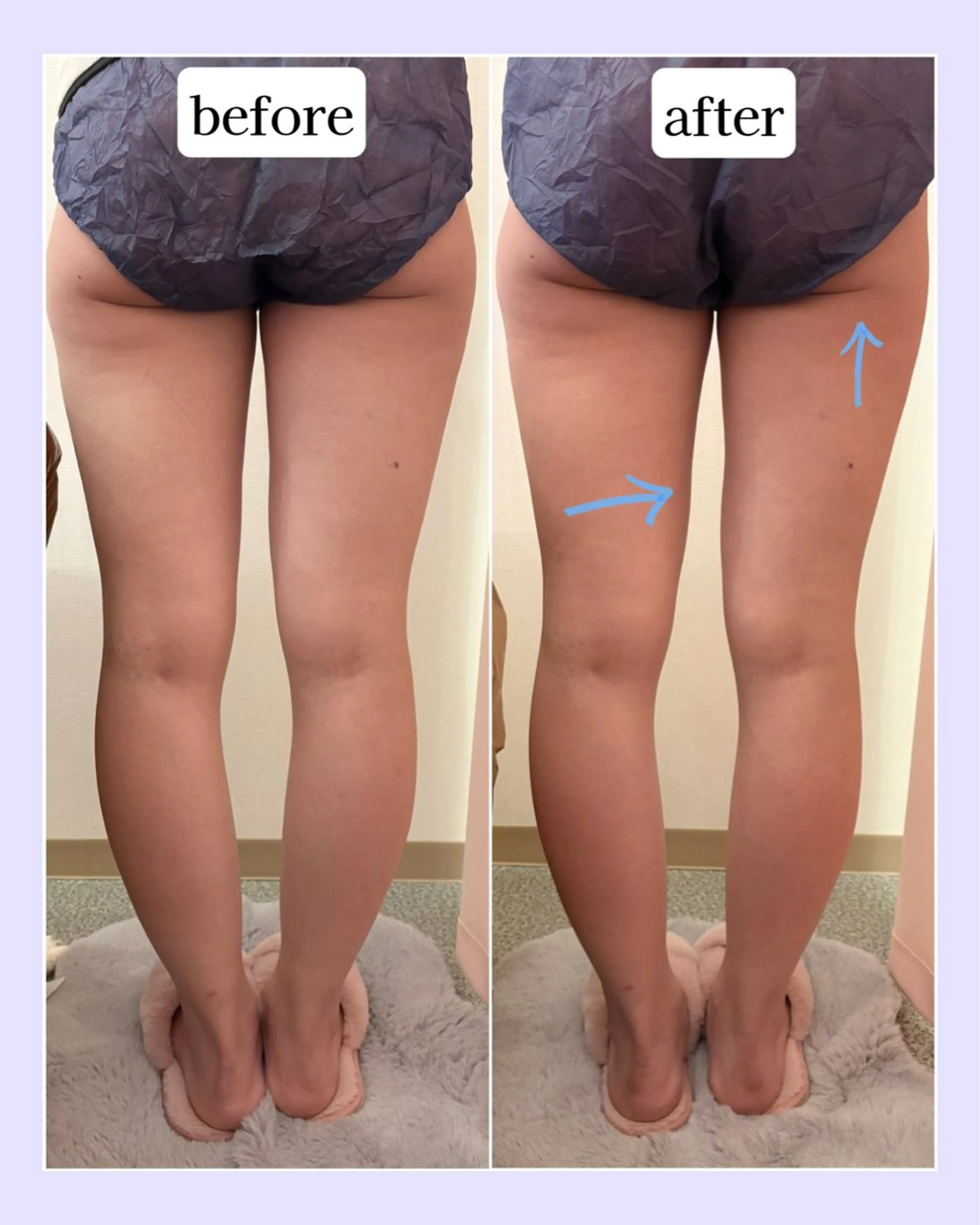 エステ 💜Karen PrivateSpaのエステ・リラクイメージ