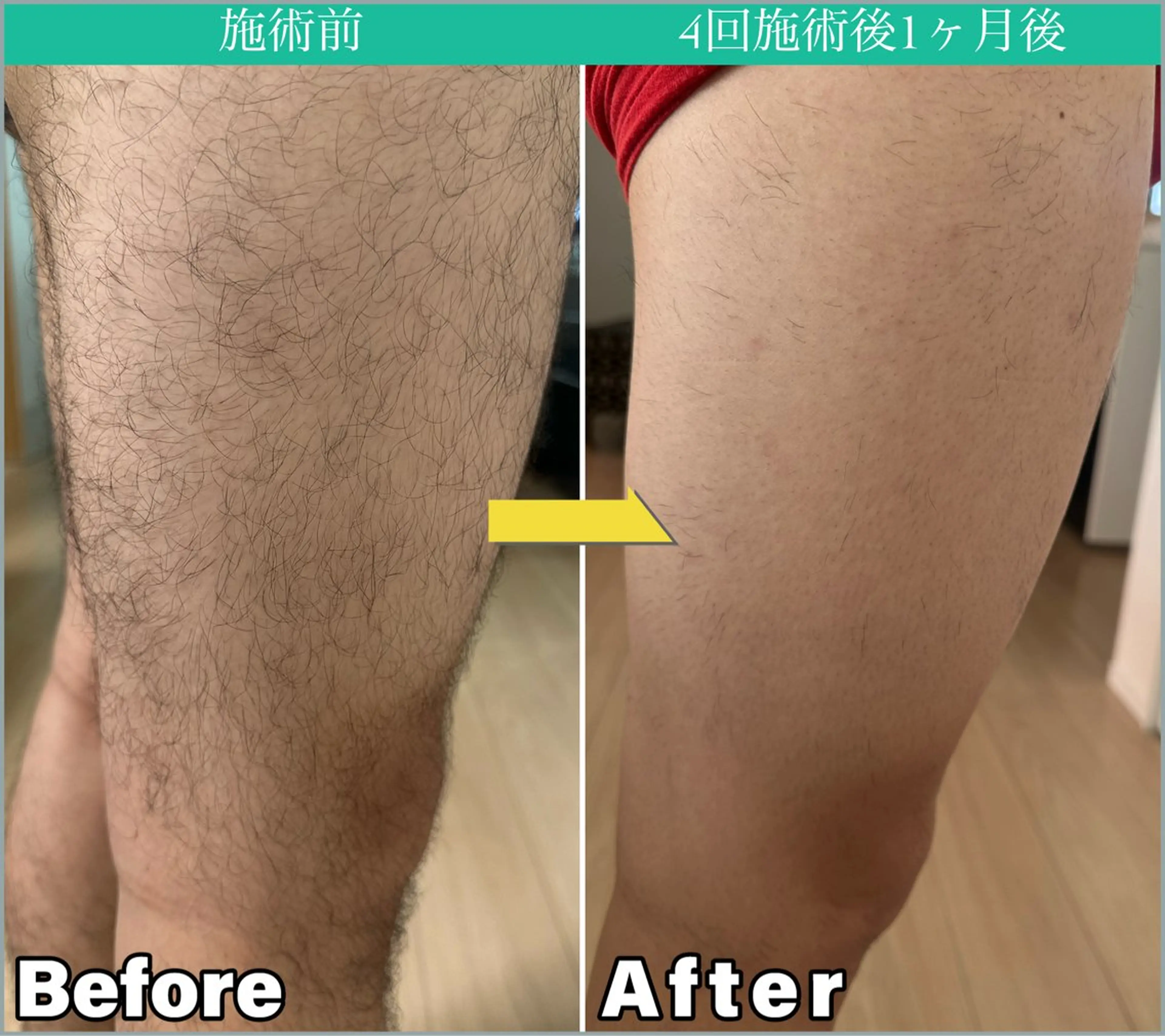 メンズ JONRY （ジョンリー）のエステ・リラクイメージ