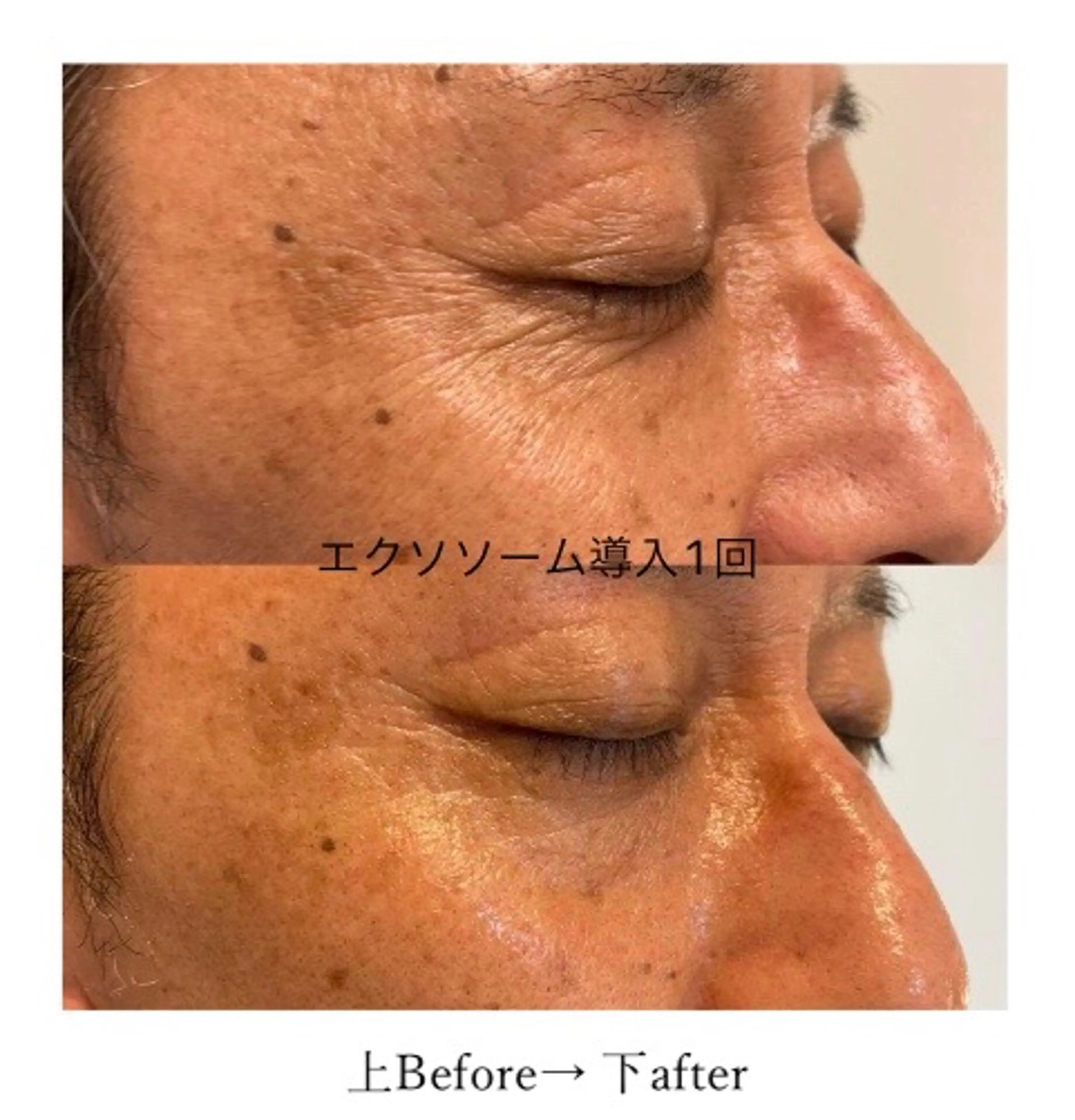 エステ ﾌﾟﾗｲﾍﾞｰﾄｻﾛﾝ アンクチュール所属・UnCouture 〜アンクチュール〜のエステ・リラクイメージ