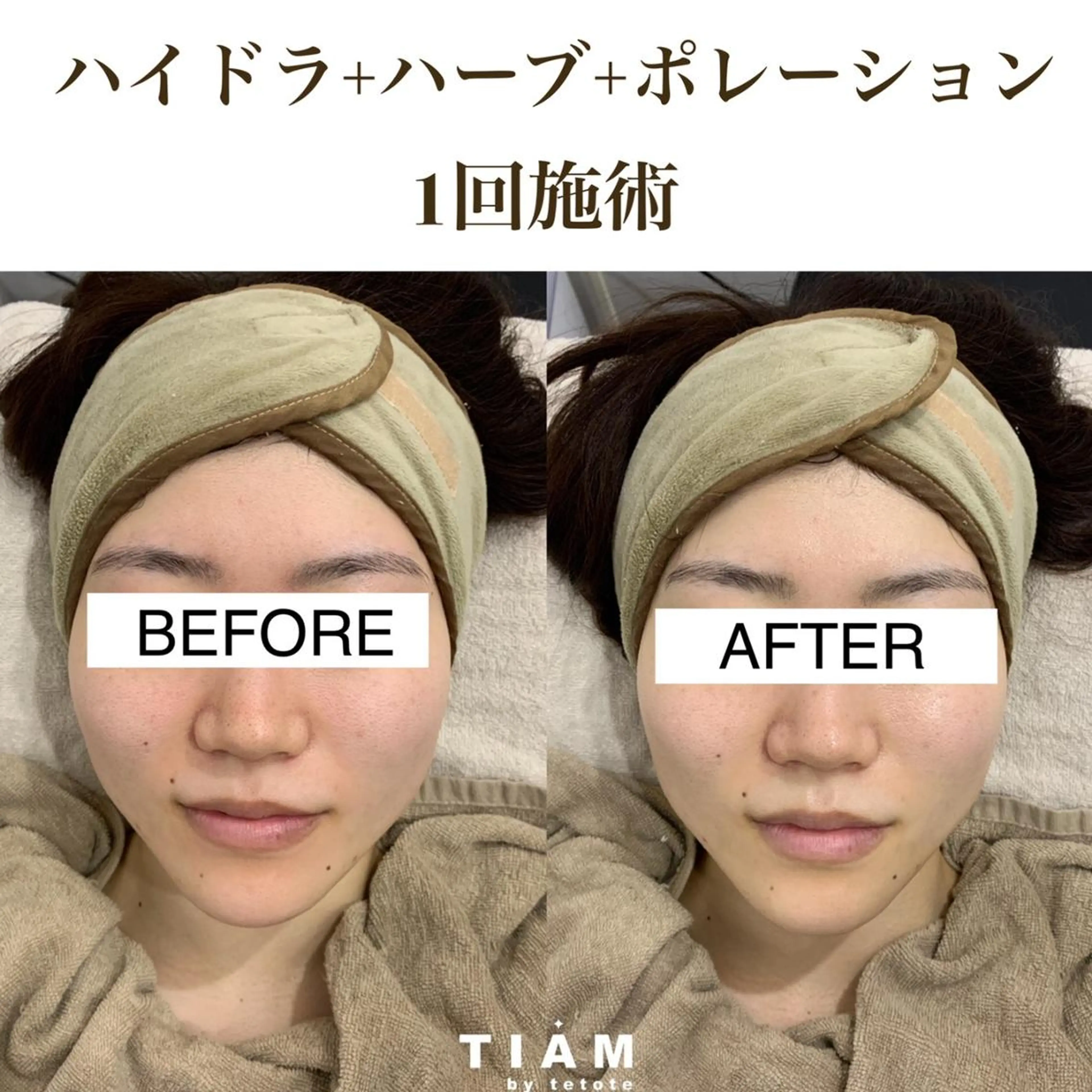 美肌サロンTIAM by tetoteのエステ・リラクイメージ