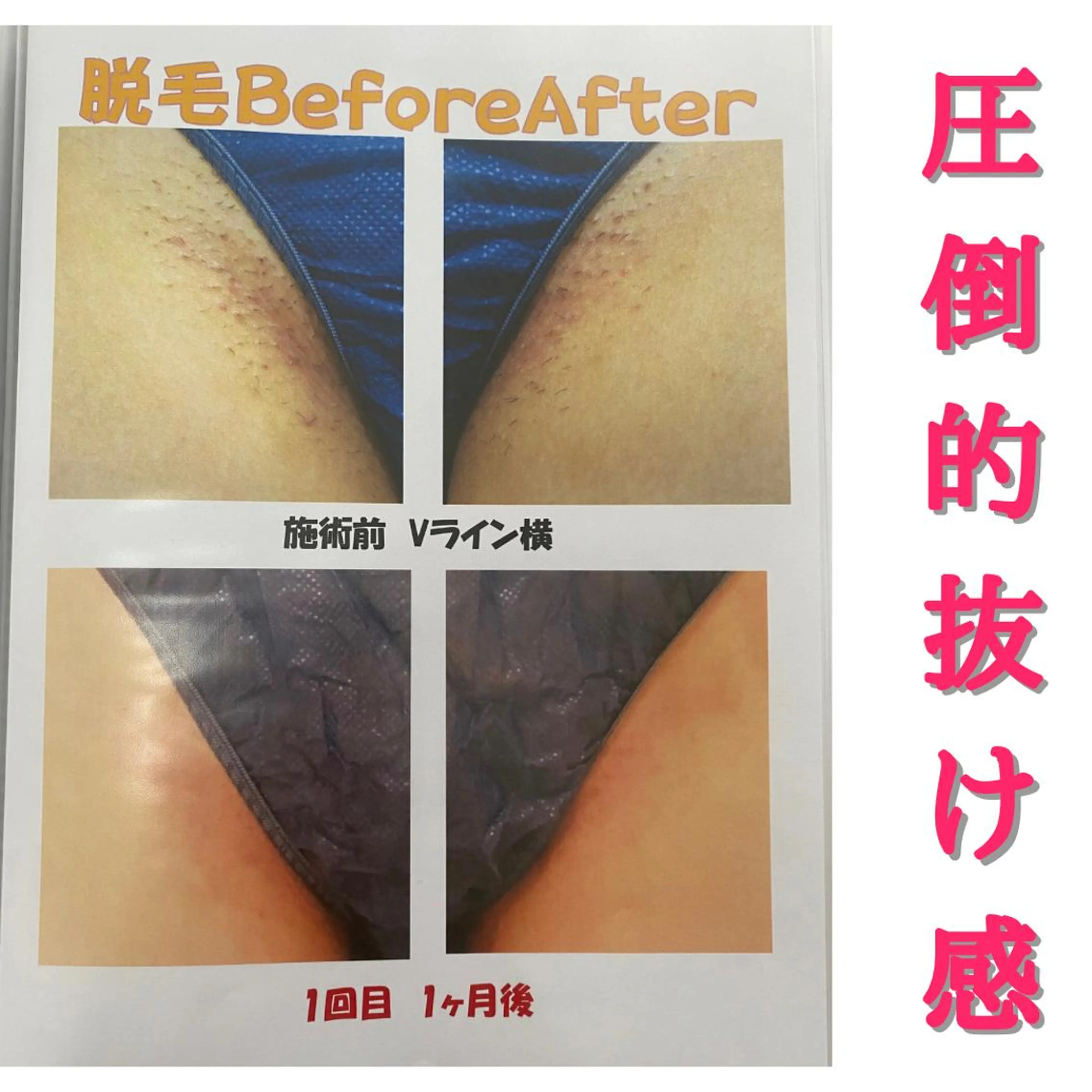 痩身リラク専門サロン 〜LUCIALL 〜のエステ・リラクイメージ