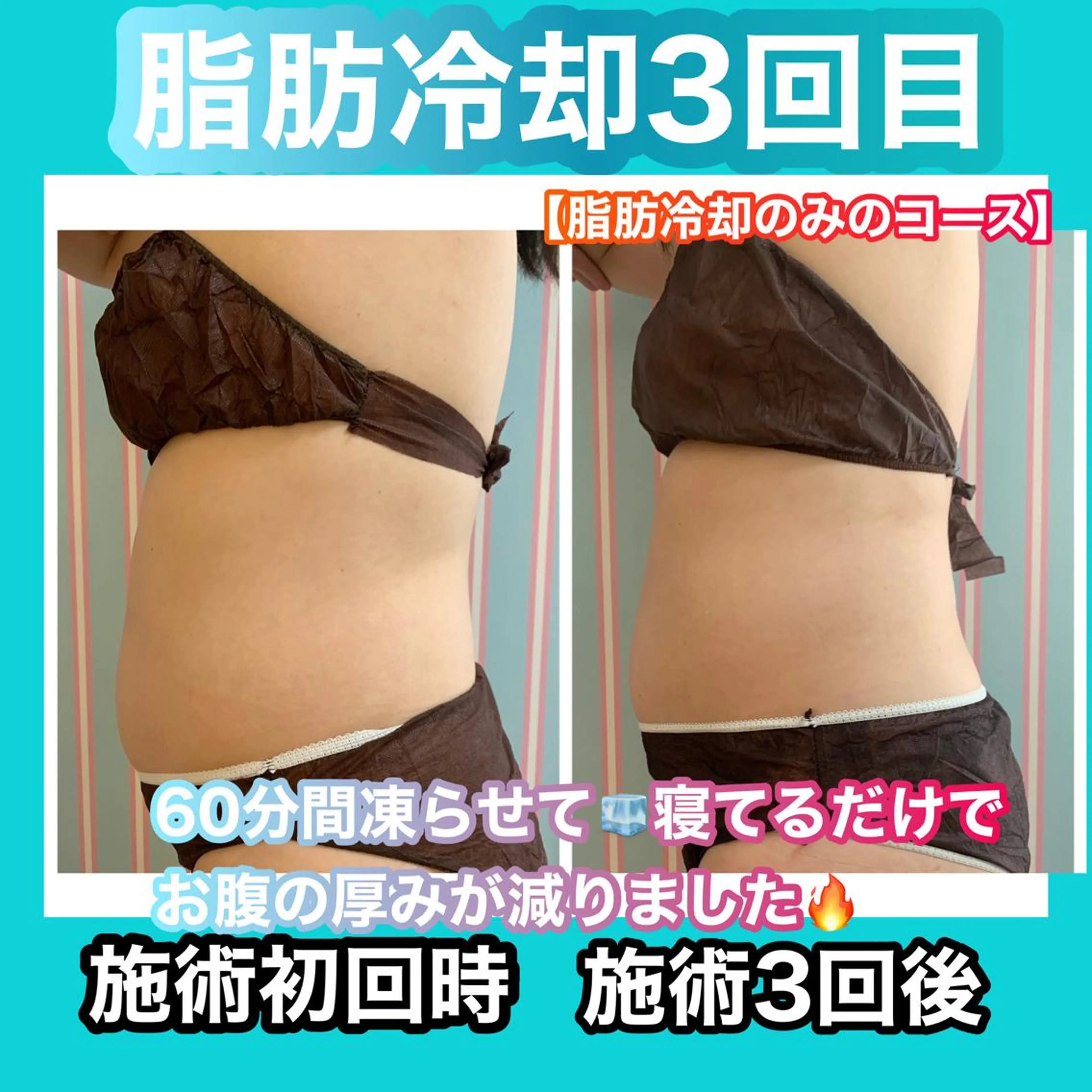 エステ リラク 痩身/脱毛/ネイル HARUKAのエステ・リラクイメージ