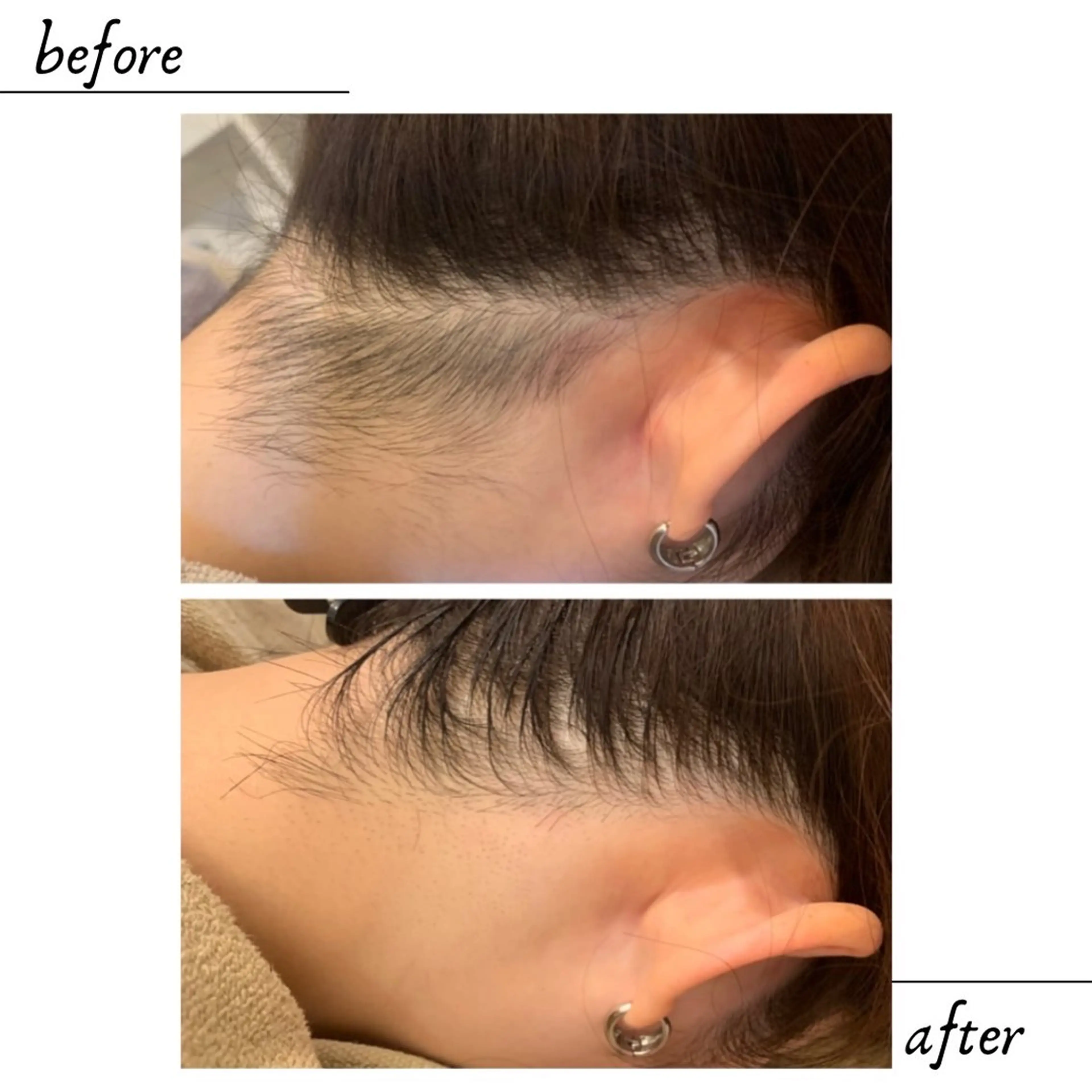 LONO  by a little所属・LONO byalittleのエステ・リラクイメージ