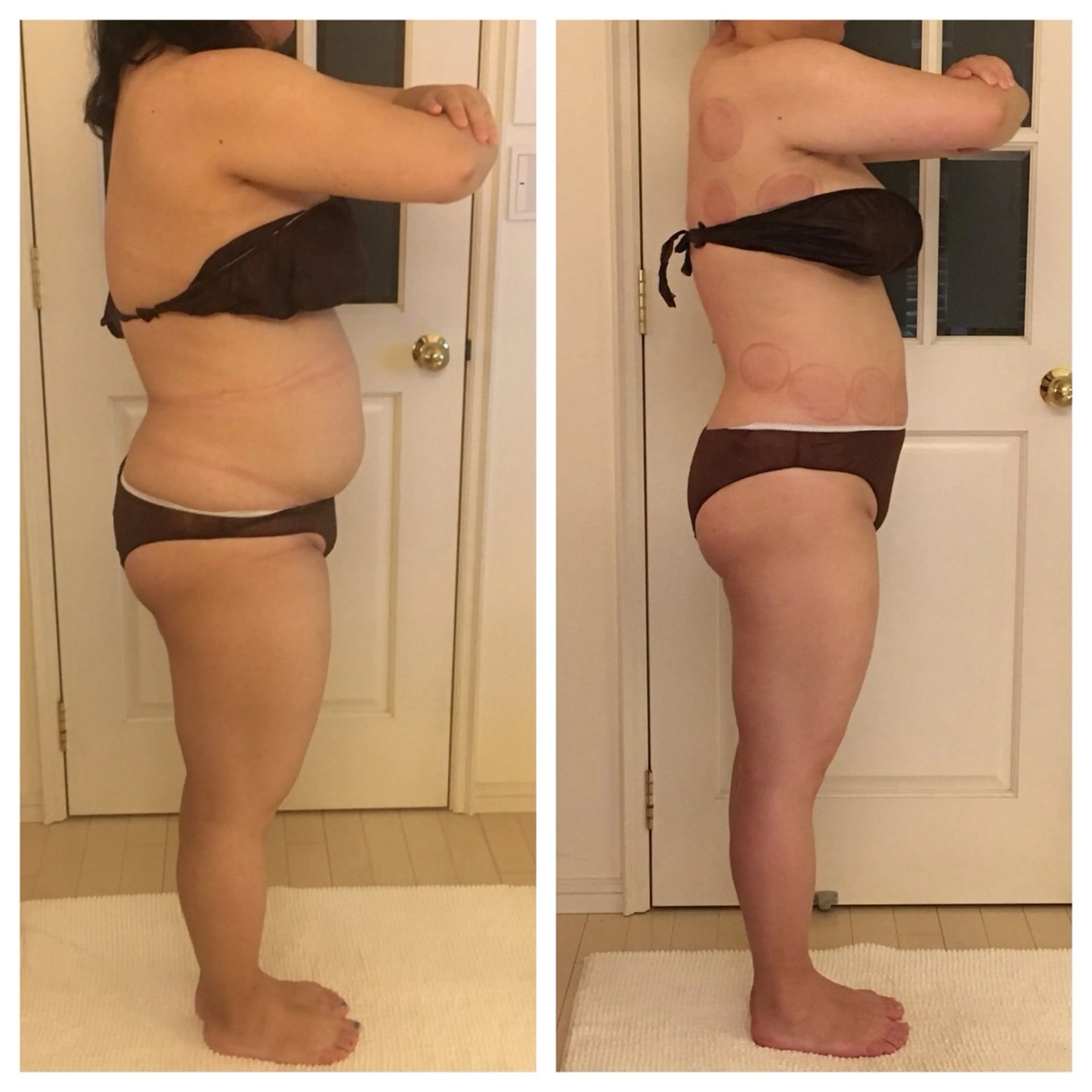 エステ リラク 超ド級痩身/ 肩こり撃退のエステ・リラクイメージ