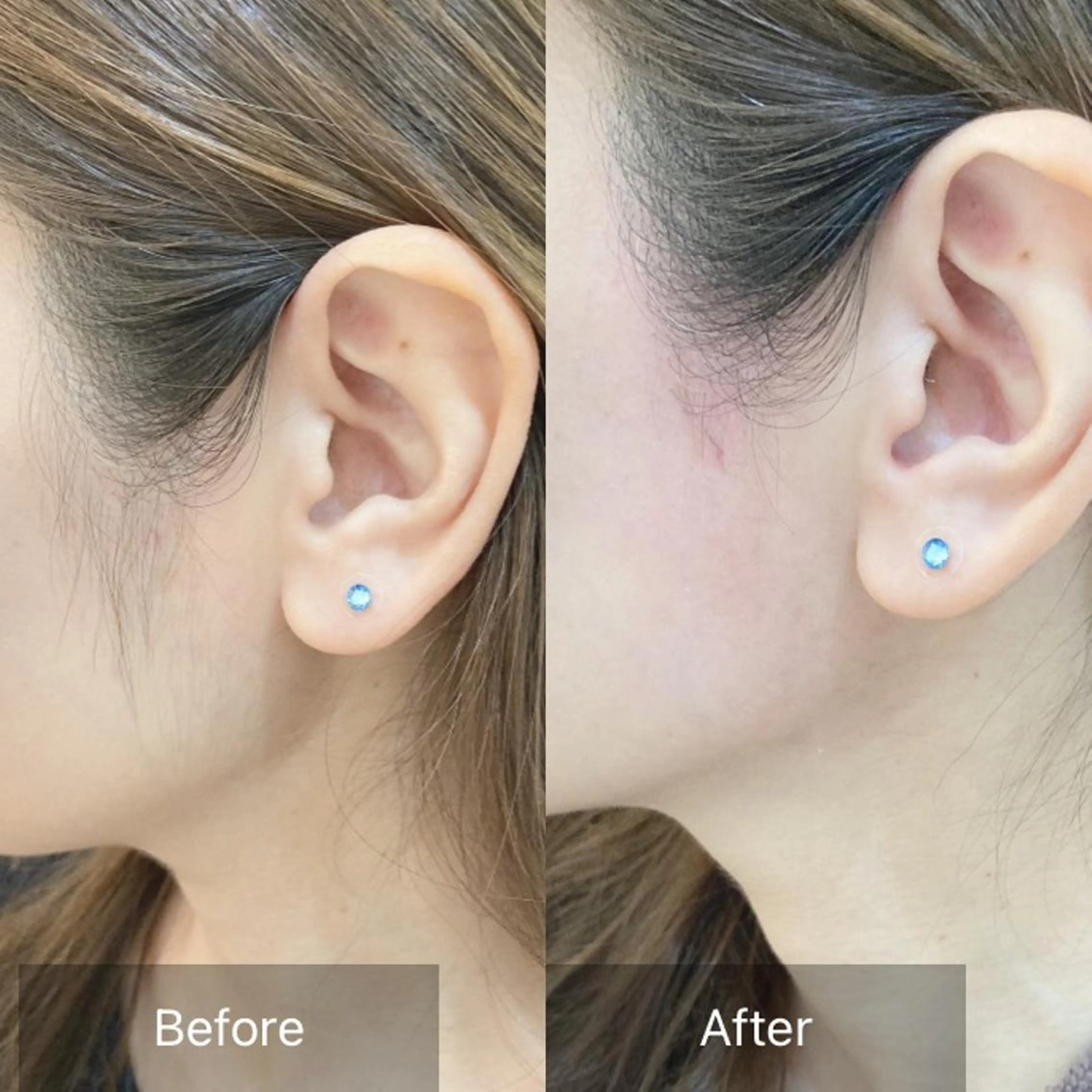 脱毛 産毛専門店 Bittoのエステ・リラクイメージ