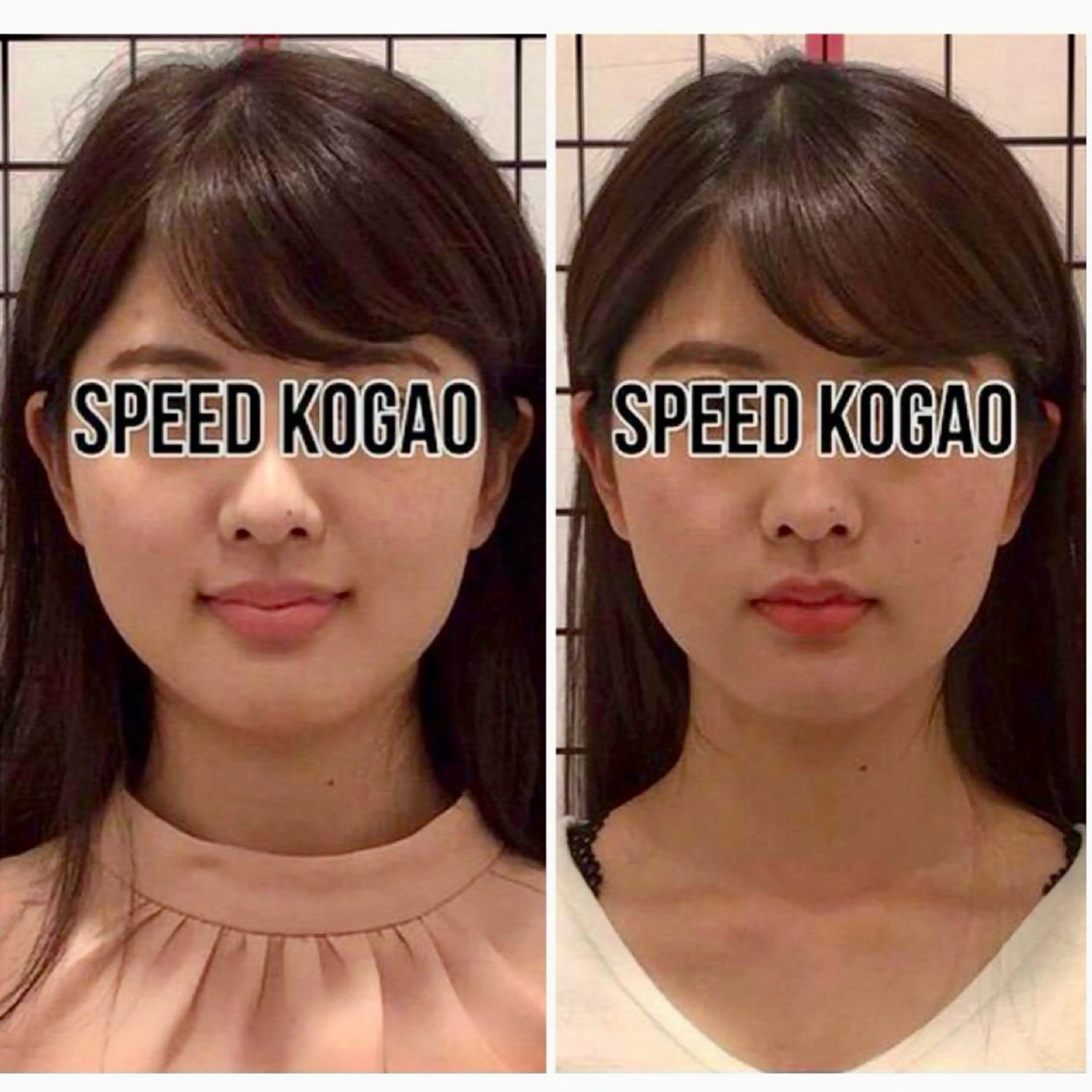 エステ リラク 小顔矯正Speed KOGAO渋谷本店のエステ・リラクイメージ