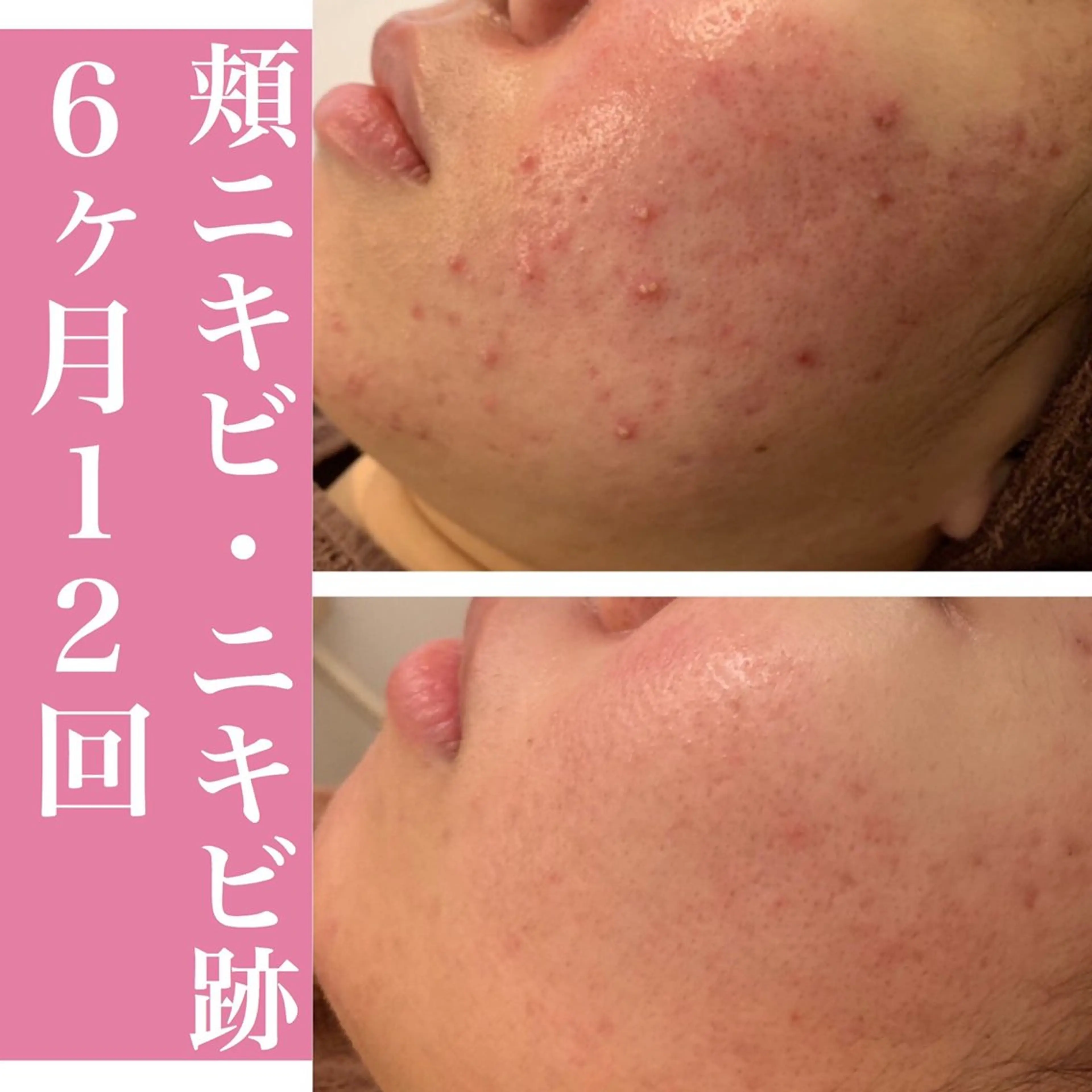 ニキビ・肌質改善専門 ♡人生が変わるサロンのエステ・リラクイメージ