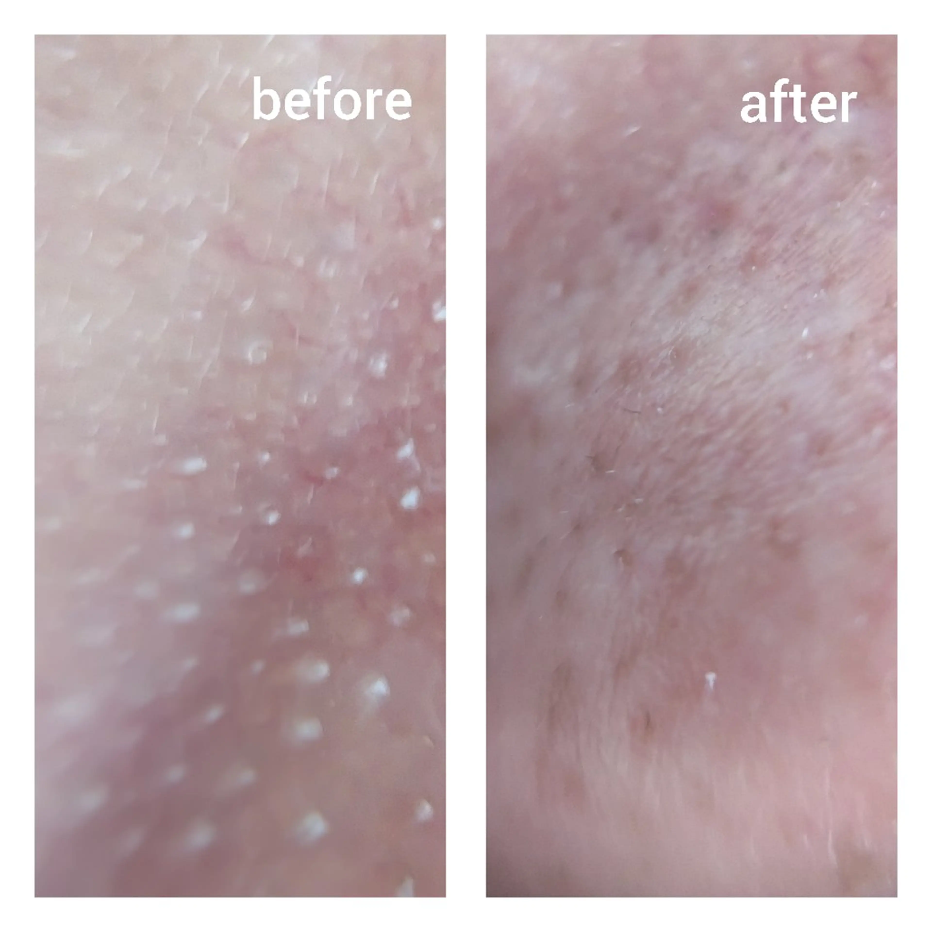 ビューティサロン Hananowaのその他イメージ