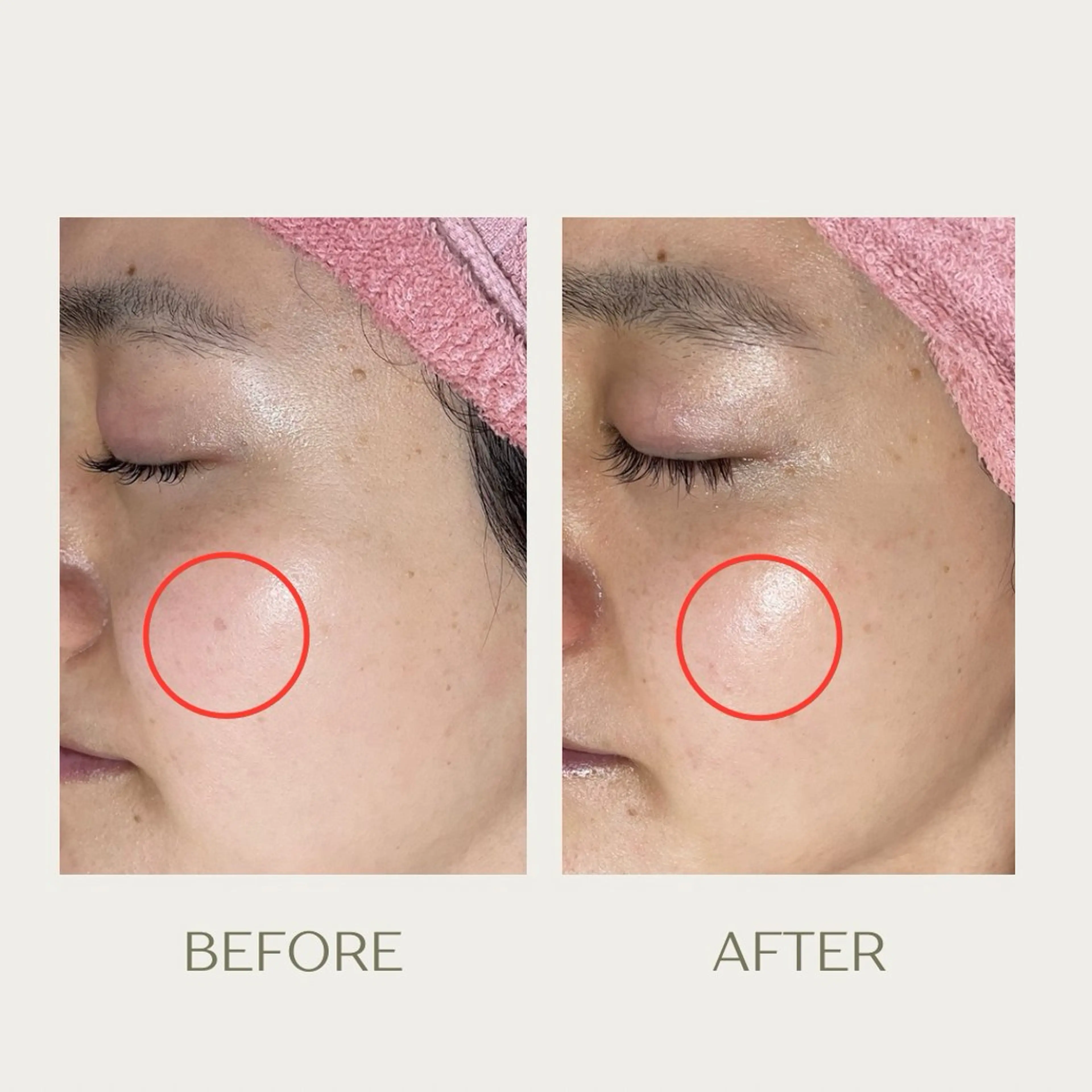 ピーリングケア 🤍moekoのその他イメージ