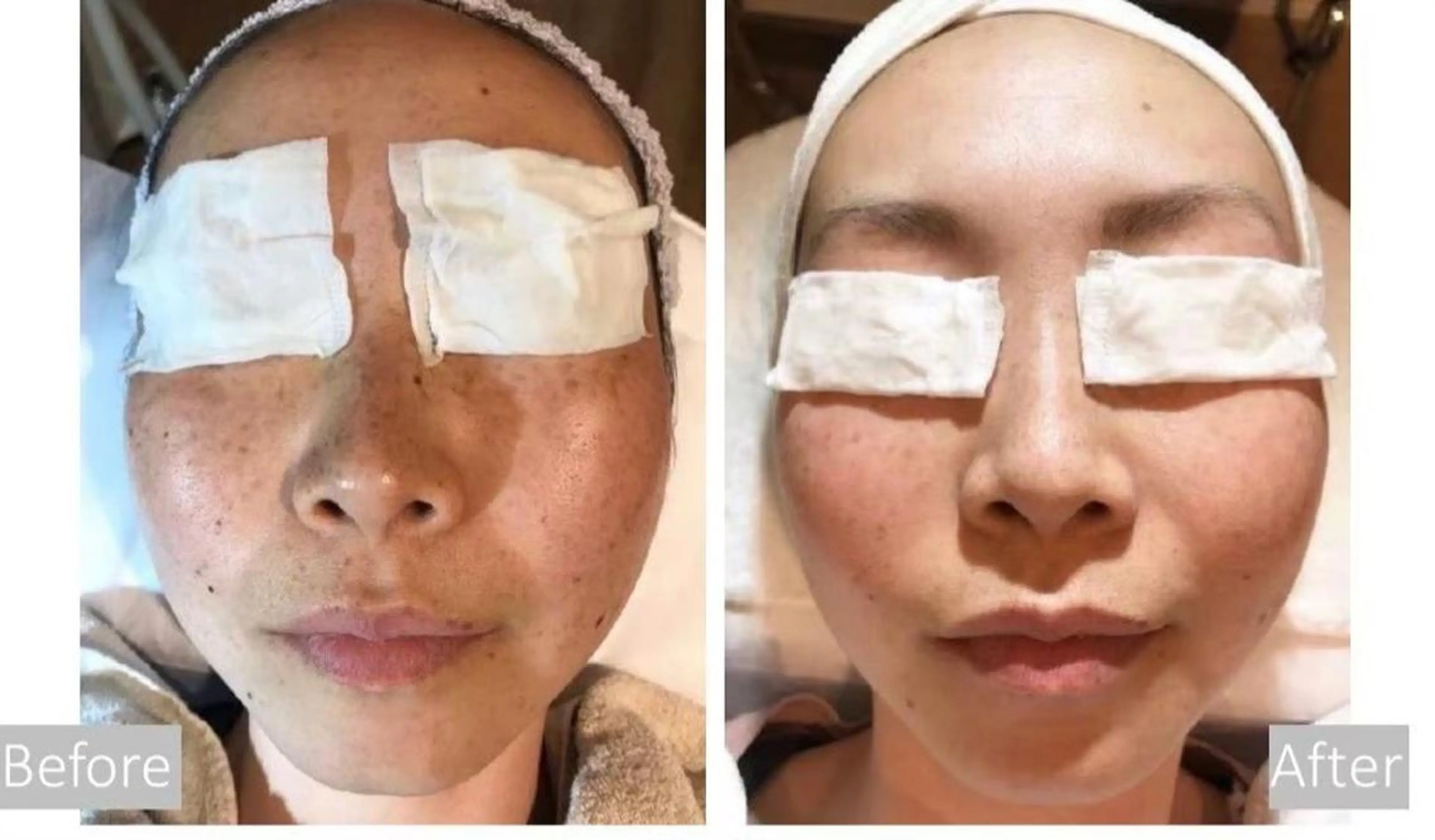 エステ 🤍SÉALIE⟡. 脱毛サロン🤍のエステ・リラクイメージ