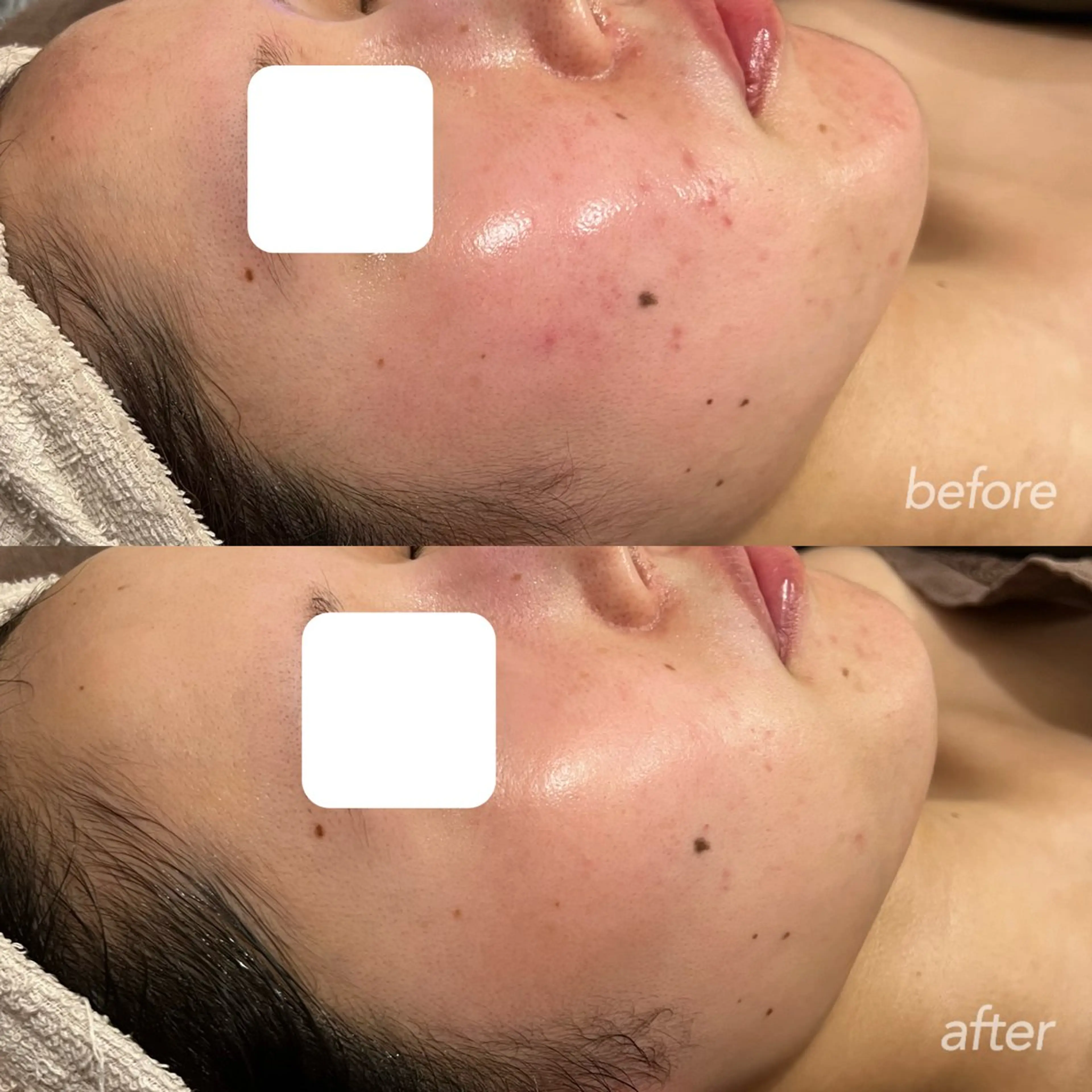 エステ 越野 Tulipe栄店のエステ・リラクイメージ