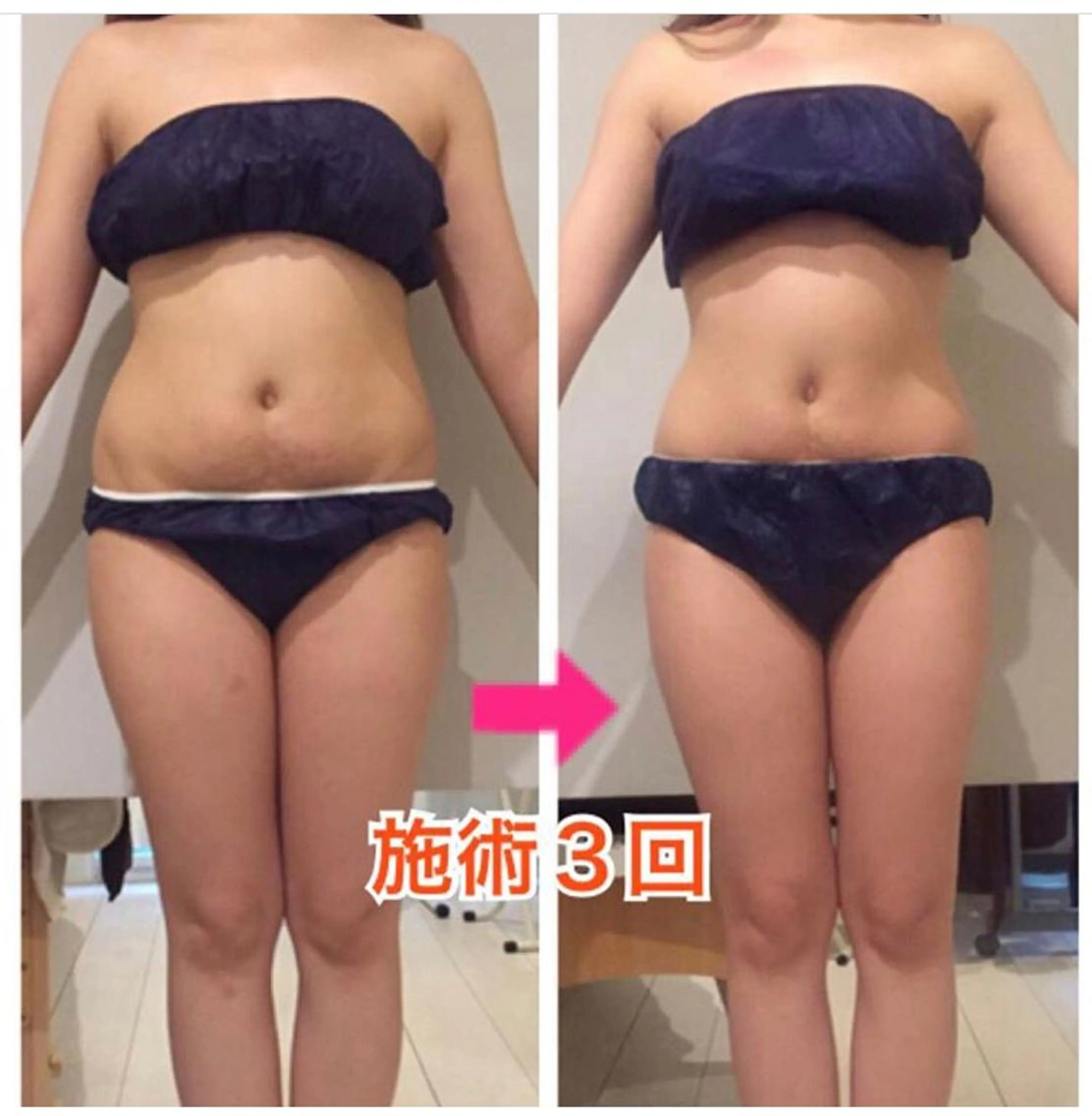 ロング カラー パーマ ヘアアレンジ メンズ キッズ ネイル マツエク・マツパ ‍痩身＆ボディ 結果出し🌟丹野のエステ・リラクイメージ