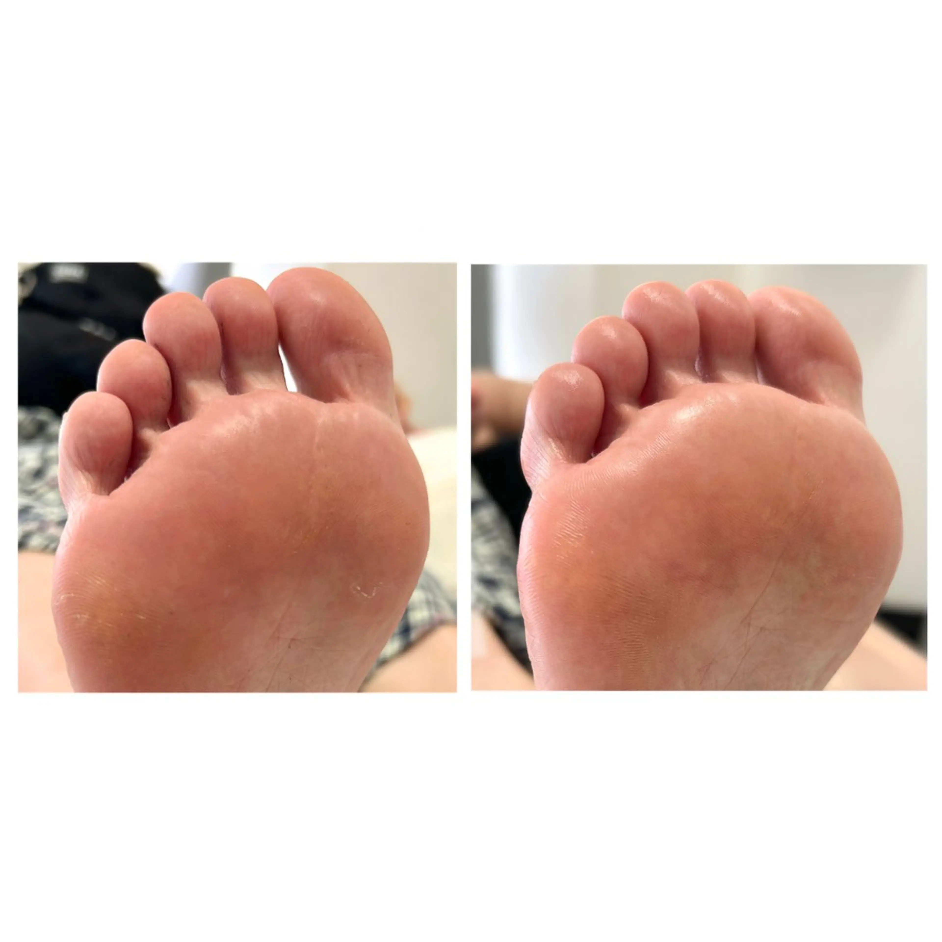 その他 なが さきのネイルデザイン