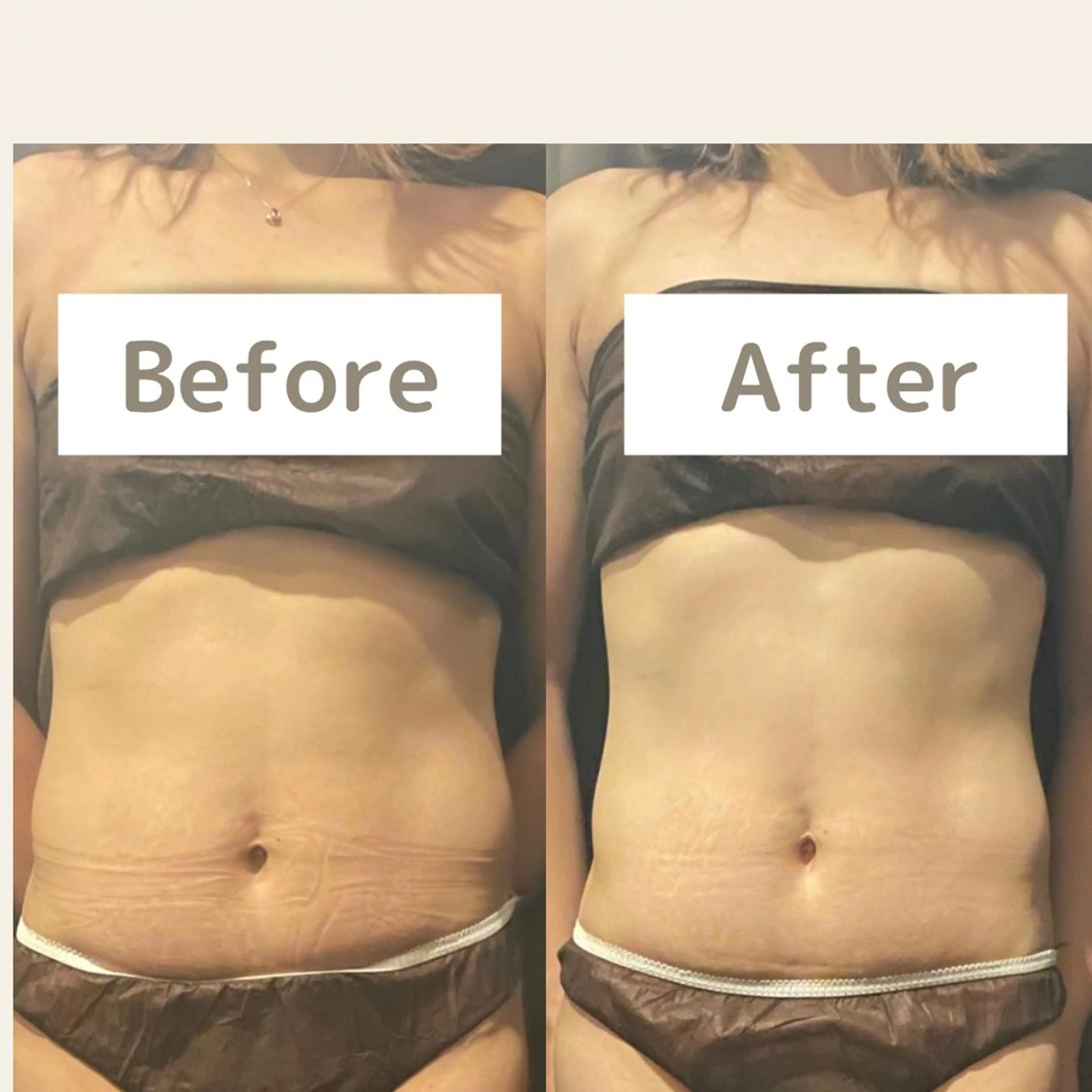 エステ 痩身・フェイシャル/if byOrabriller所属・if byOrab riller【イフ】のその他イメージ