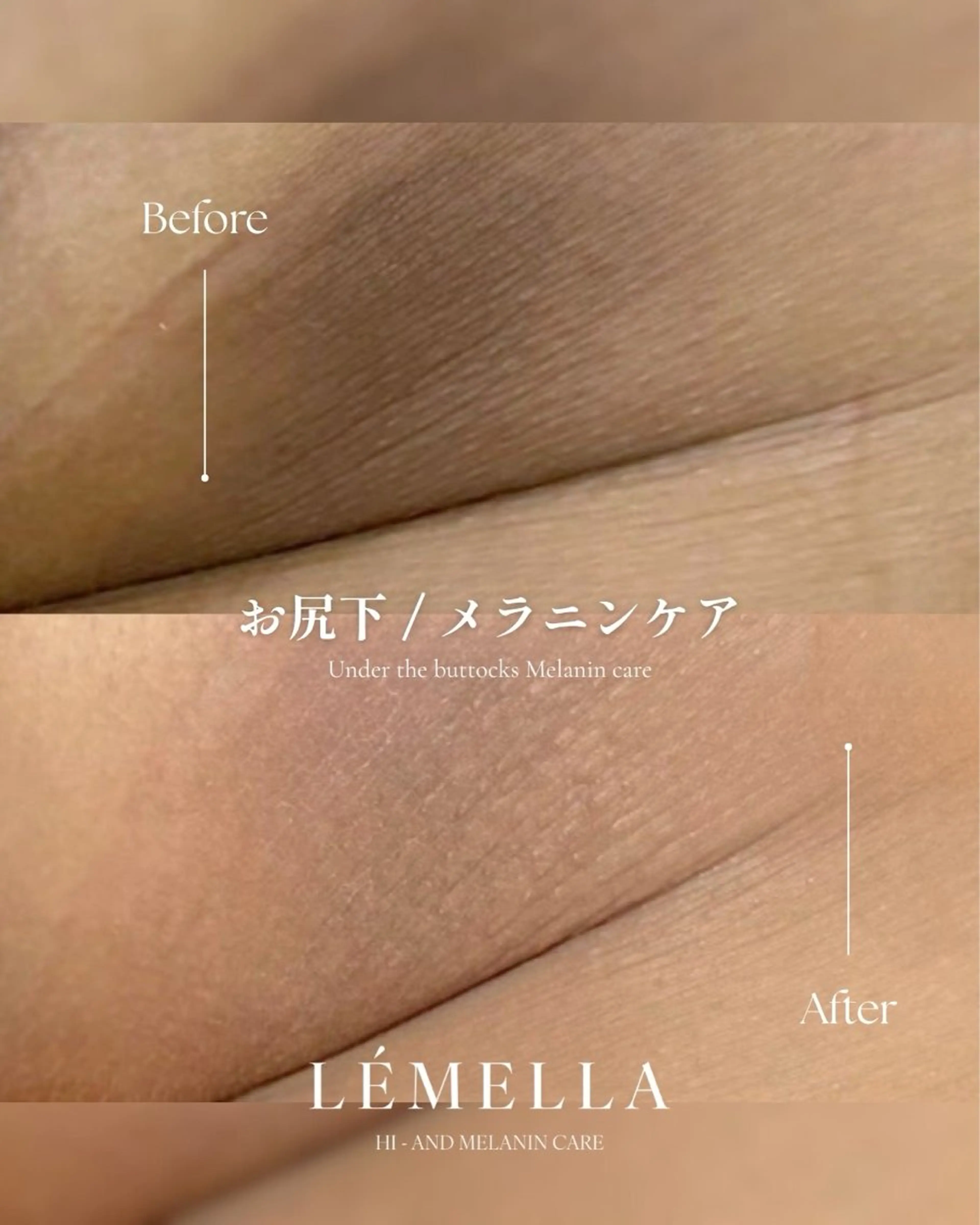 メラニンケアサロンM/é（エムエ）所属・メラニンケア M/é柴田のその他イメージ