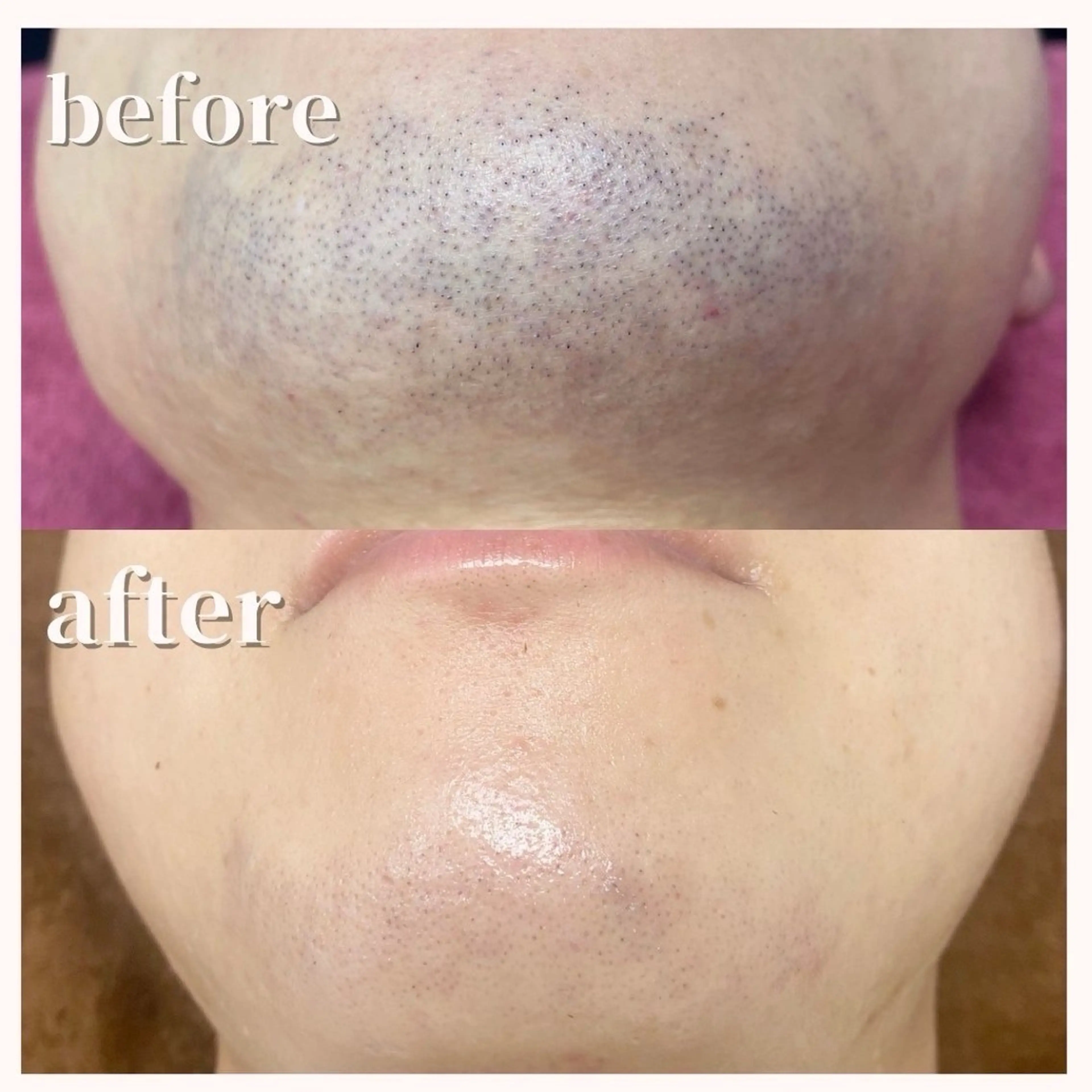 脱毛 軽部 歩のエステ・リラクイメージ