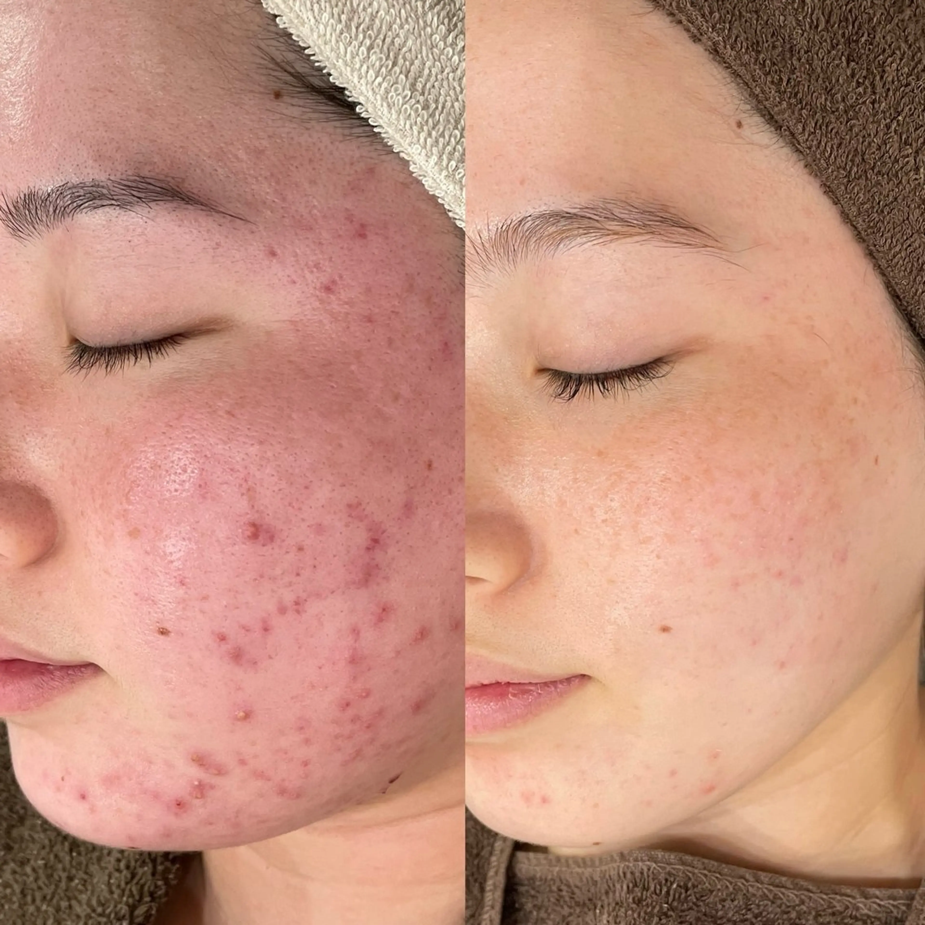 その他 エステサロンTug 高知駅前店のエステ・リラクイメージ