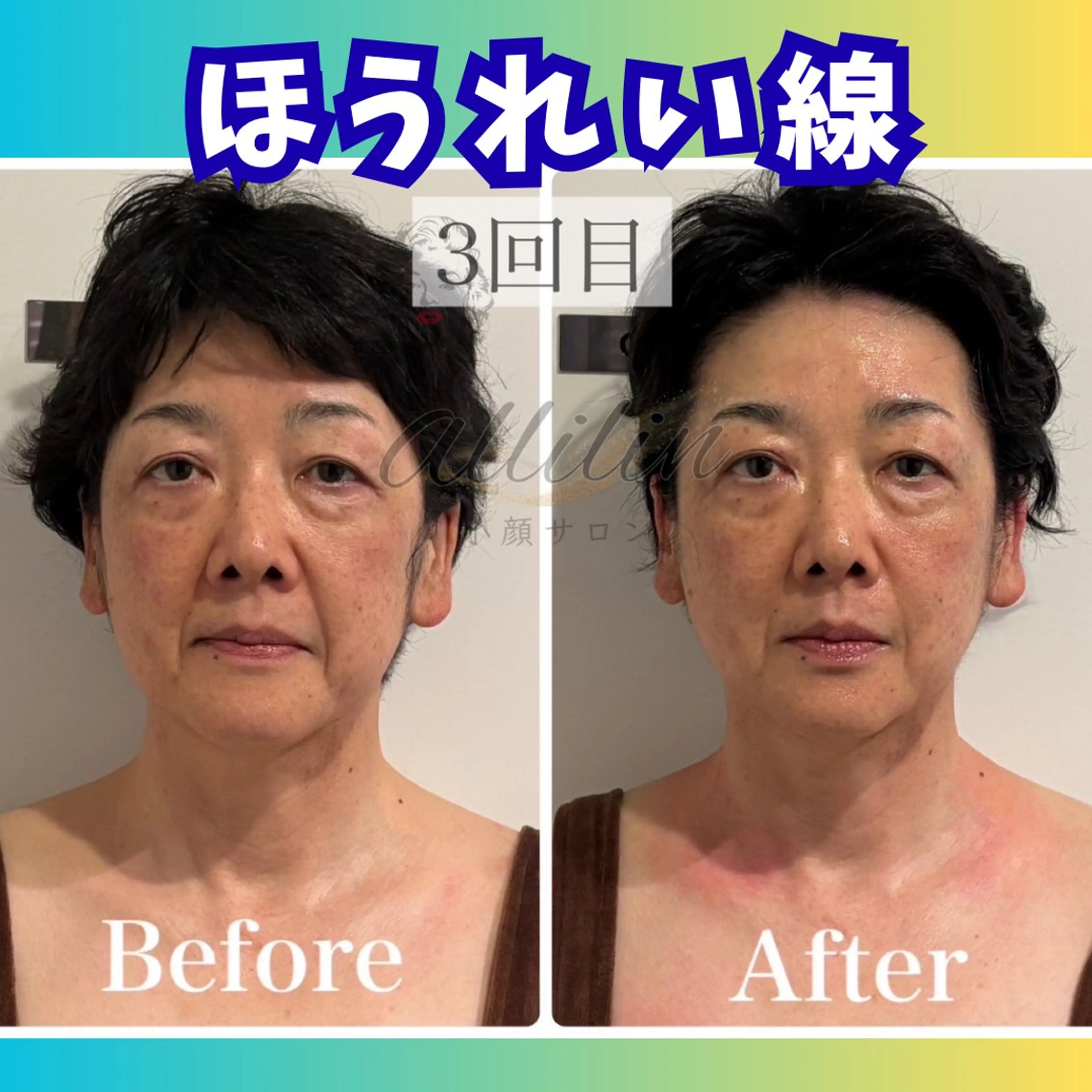 💎小顔ｻﾛﾝ アリリン銀座💎のエステ・リラクイメージ