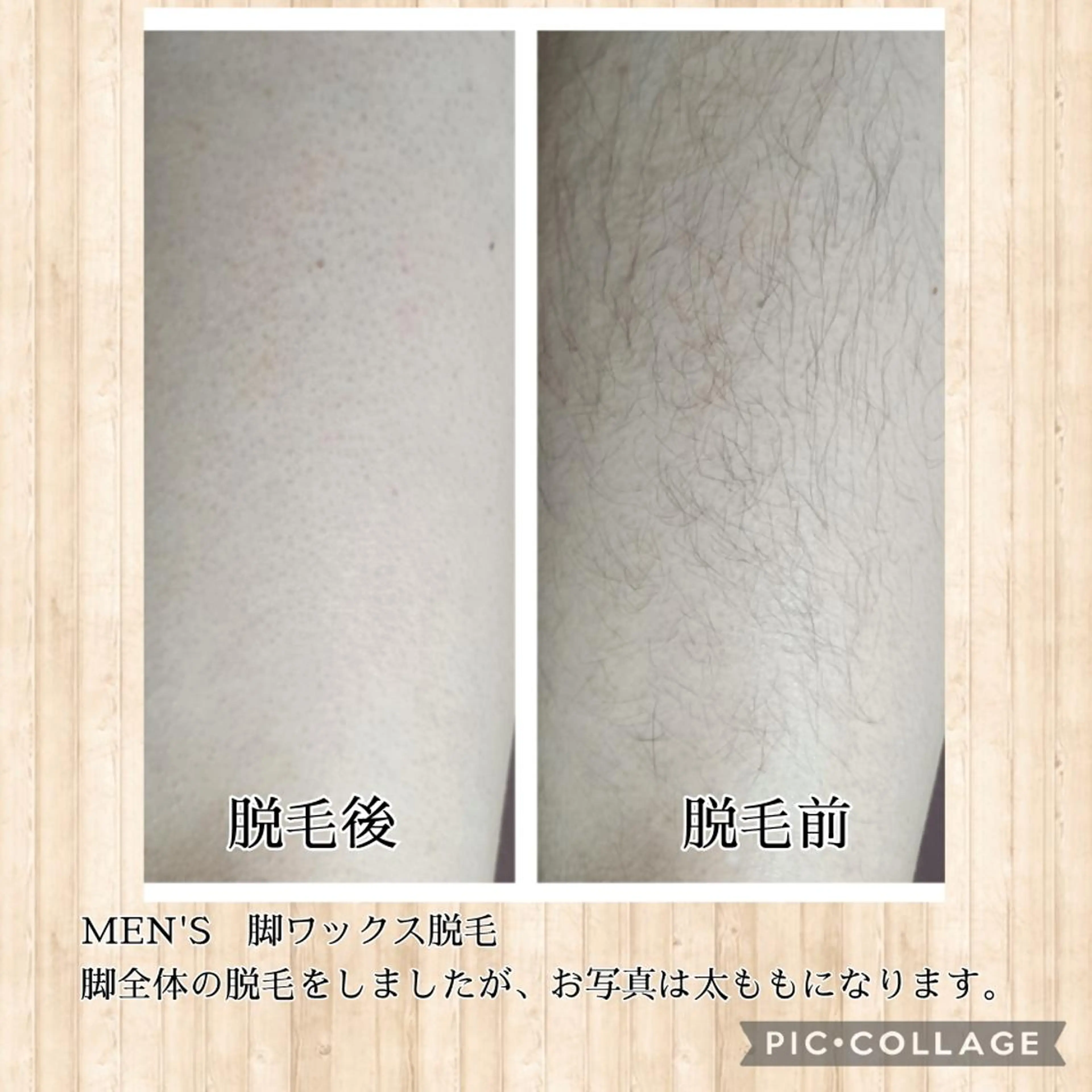 メンズ ワックス脱毛専門店 Lutellaのエステ・リラクイメージ