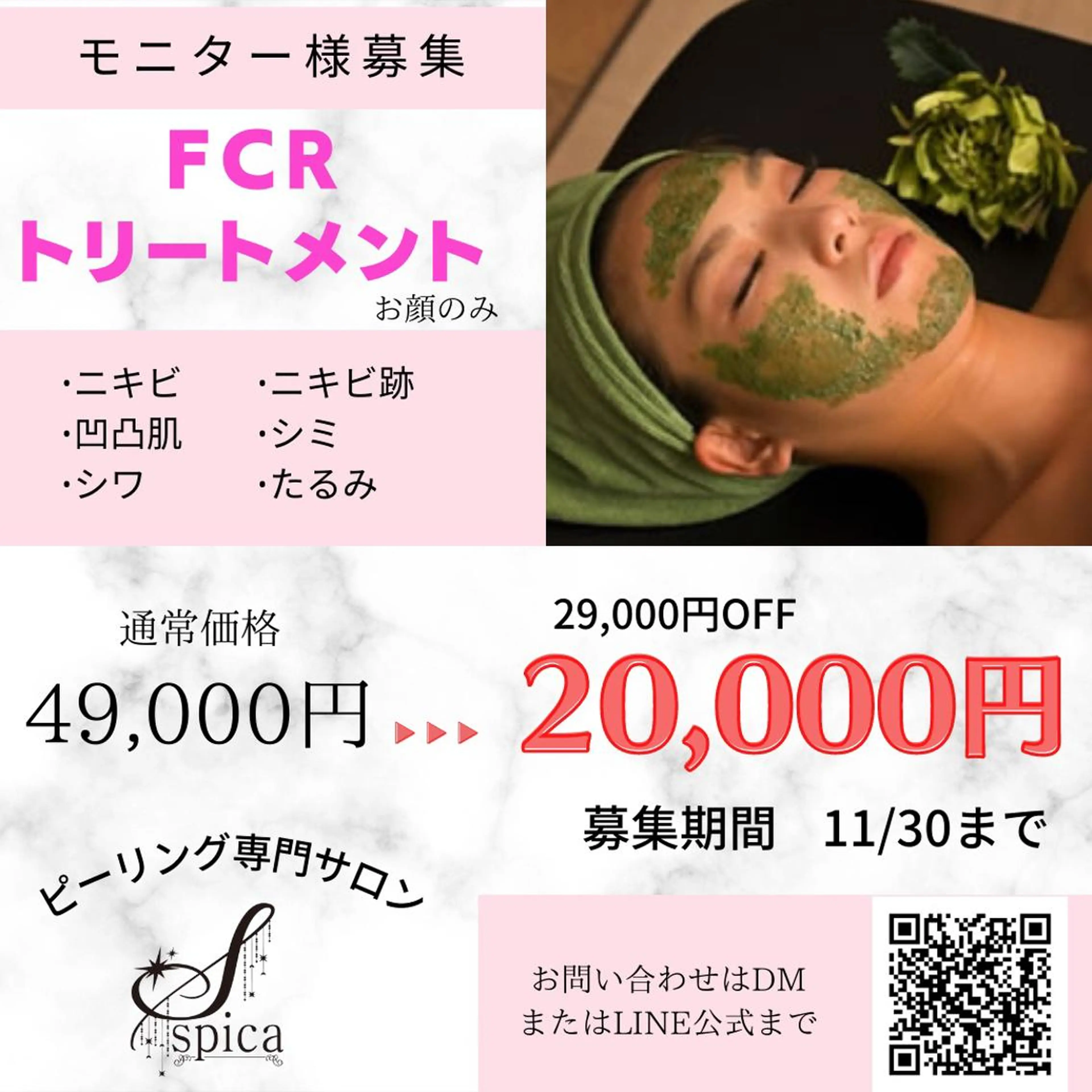 その他 ピーリング専門サロン Spicaのエステ・リラクイメージ