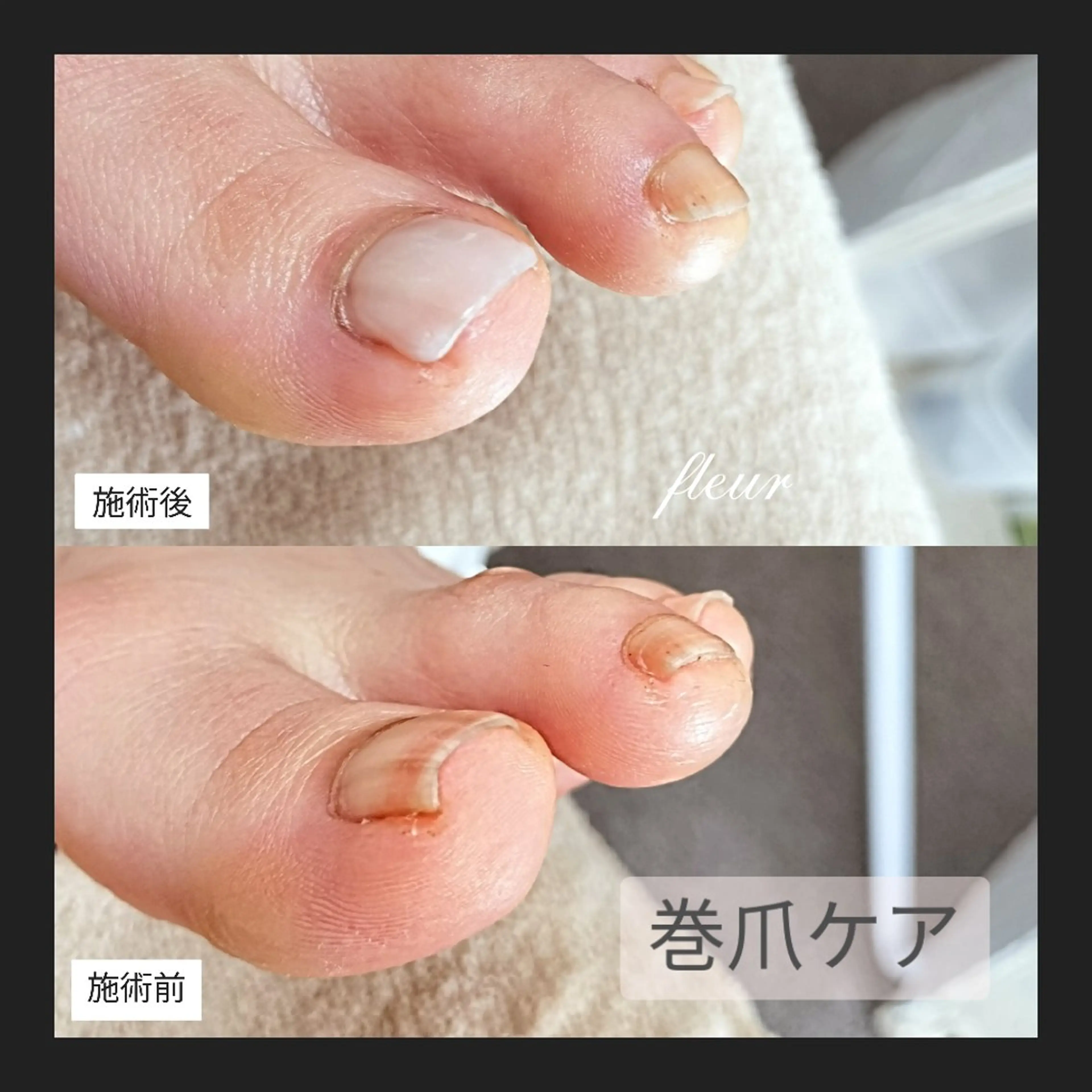 ネイル クリアネイル フットネイル ジェルネイル ワンカラーネイル megumi. sのネイルデザイン