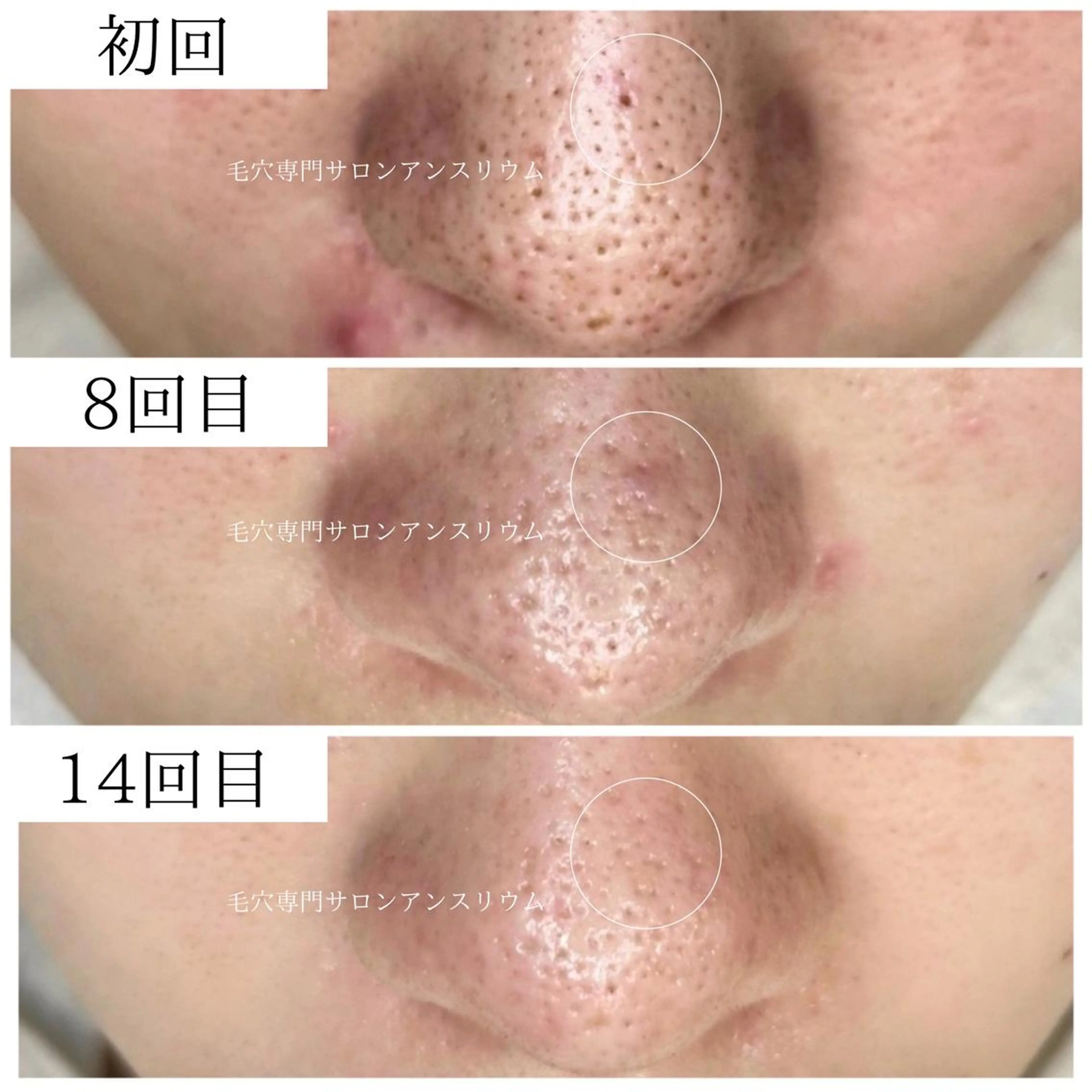 茨城土浦 つくば毛穴 ケア専門サロンのエステ・リラクイメージ