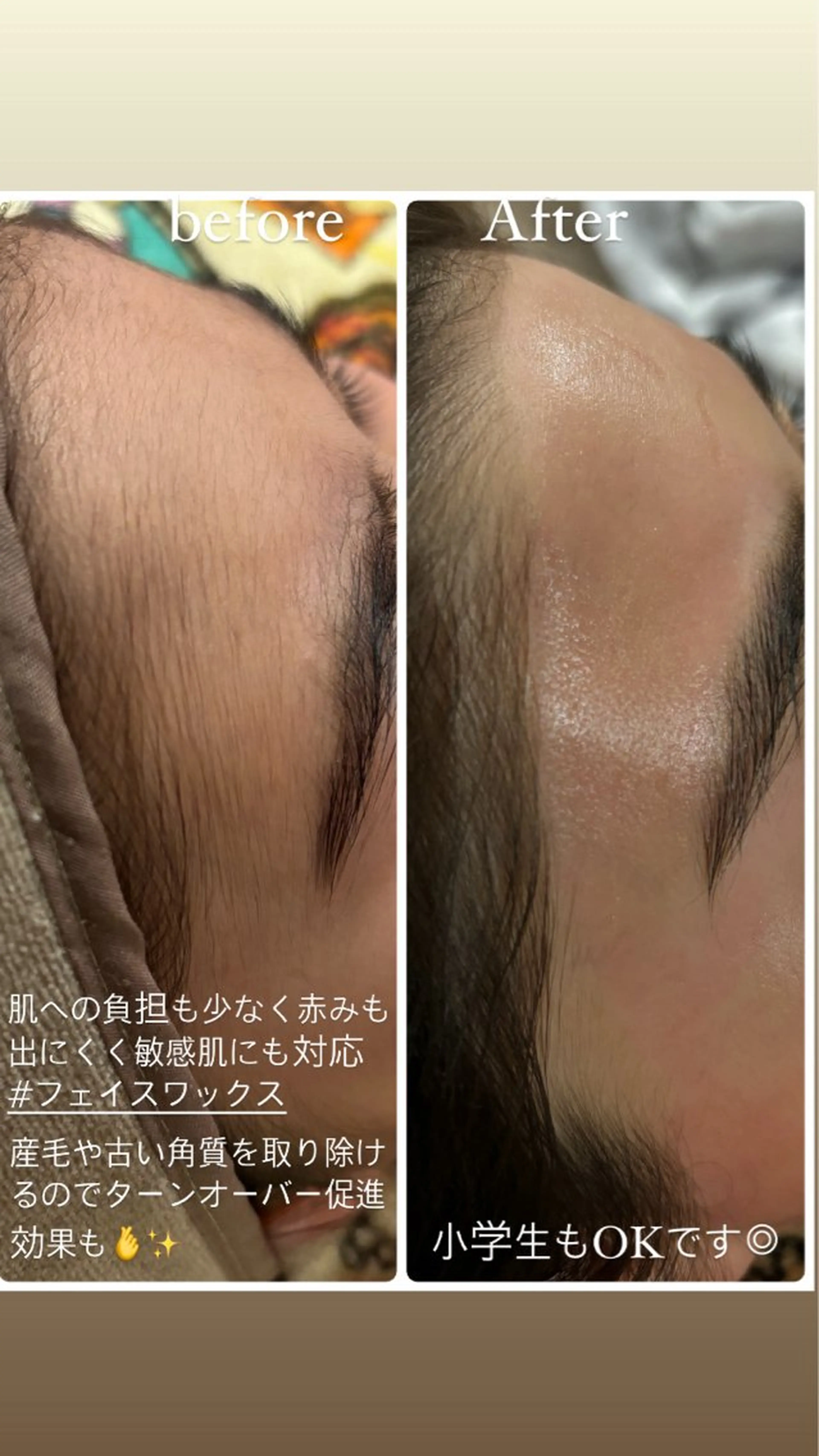 エステ sourire.11 ‪☺︎‬‪emiのその他イメージ