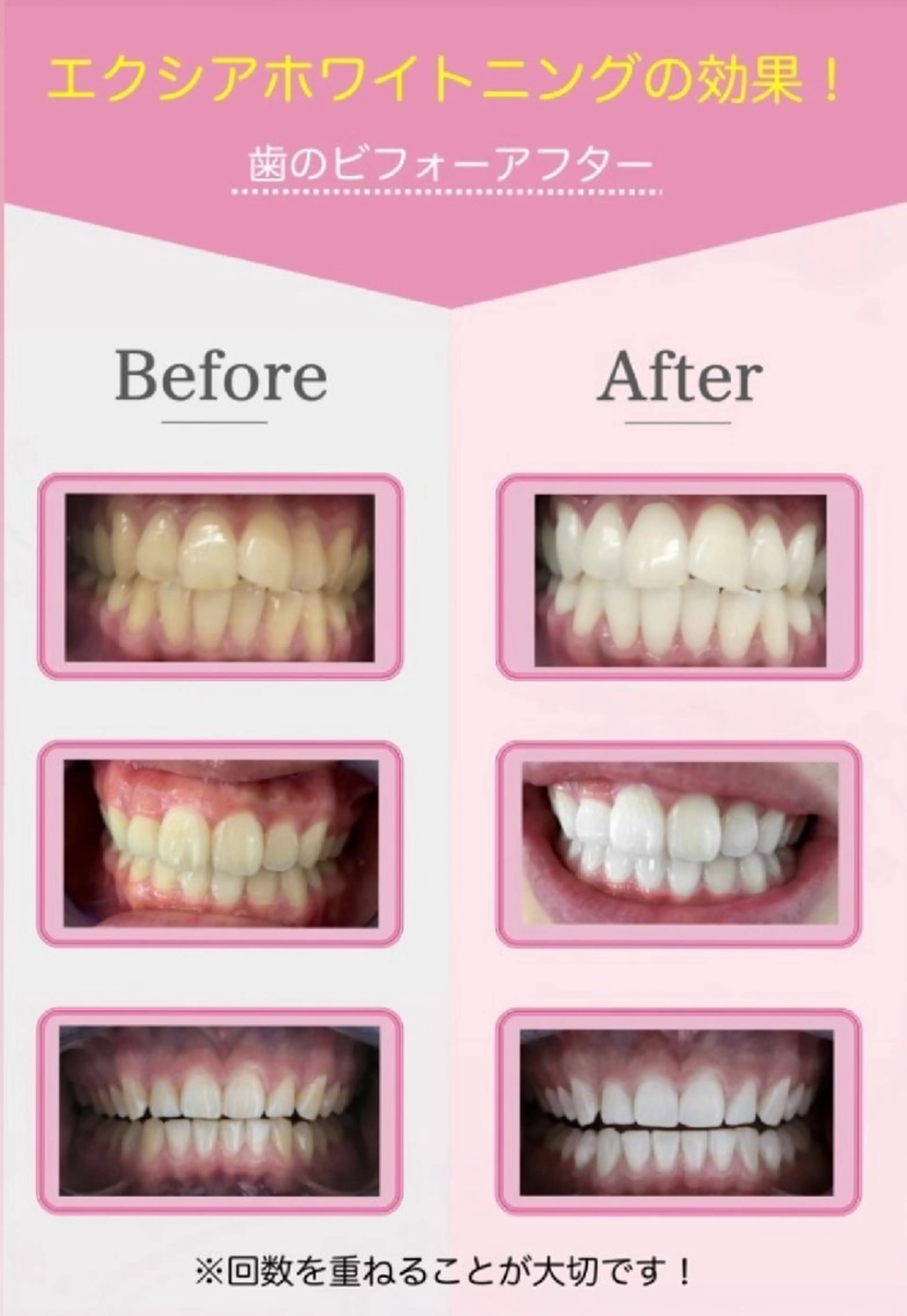 その他 セルフホワイトニング エクシア大宮東口店のその他イメージ