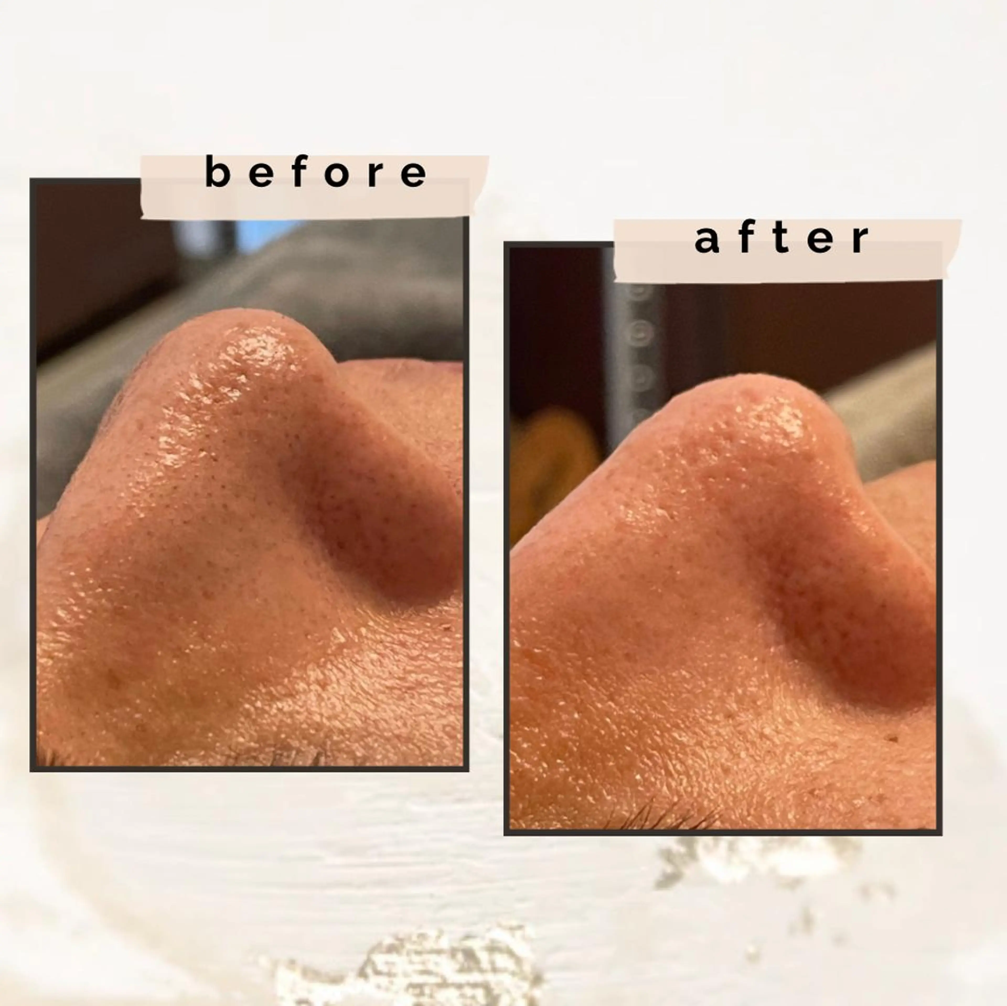 腸もみ・メンズ脱毛・ 毛穴洗浄〜カナロア〜のエステ・リラクイメージ