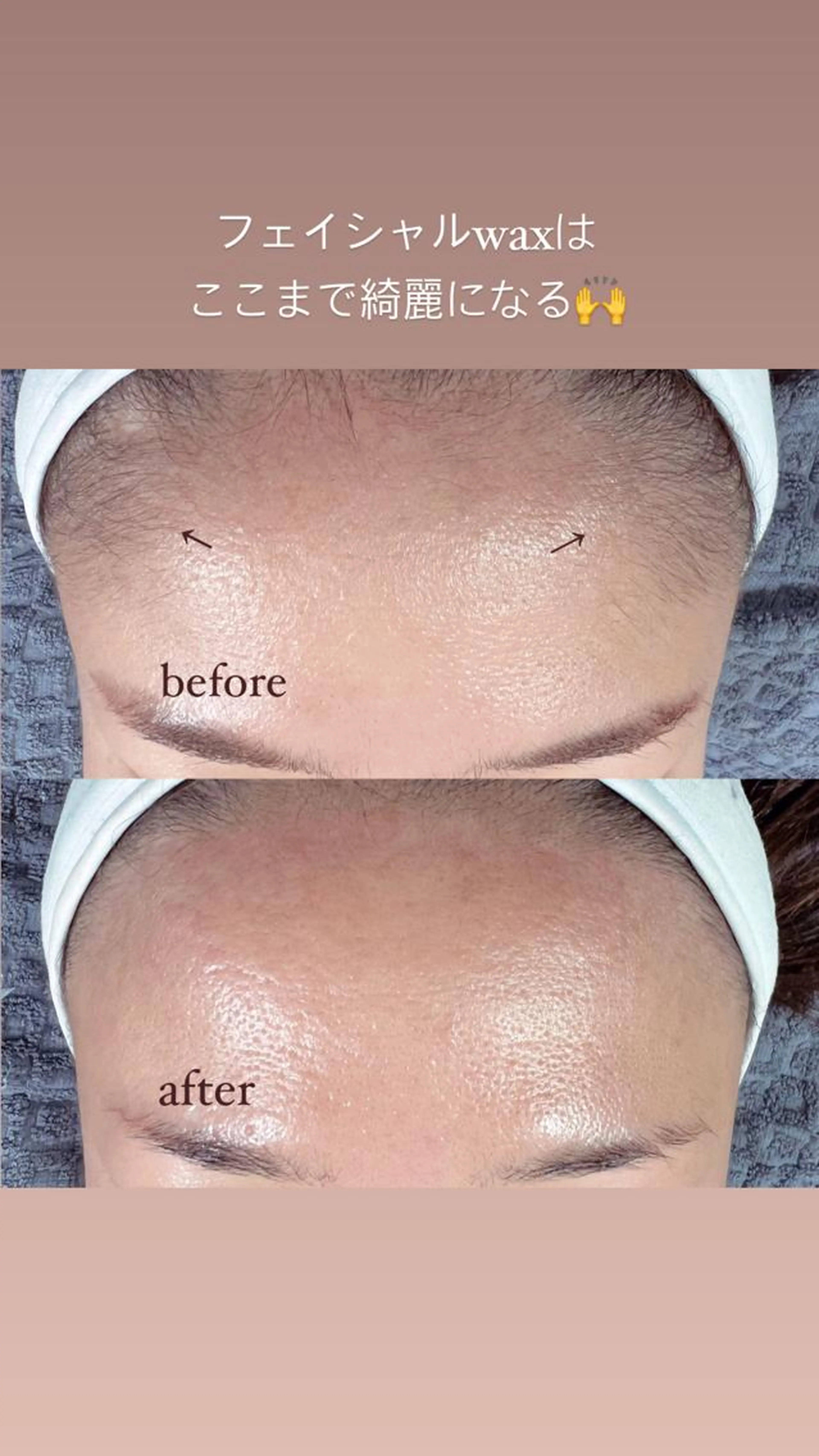ミニモ価格フェイシャルwaxの写真