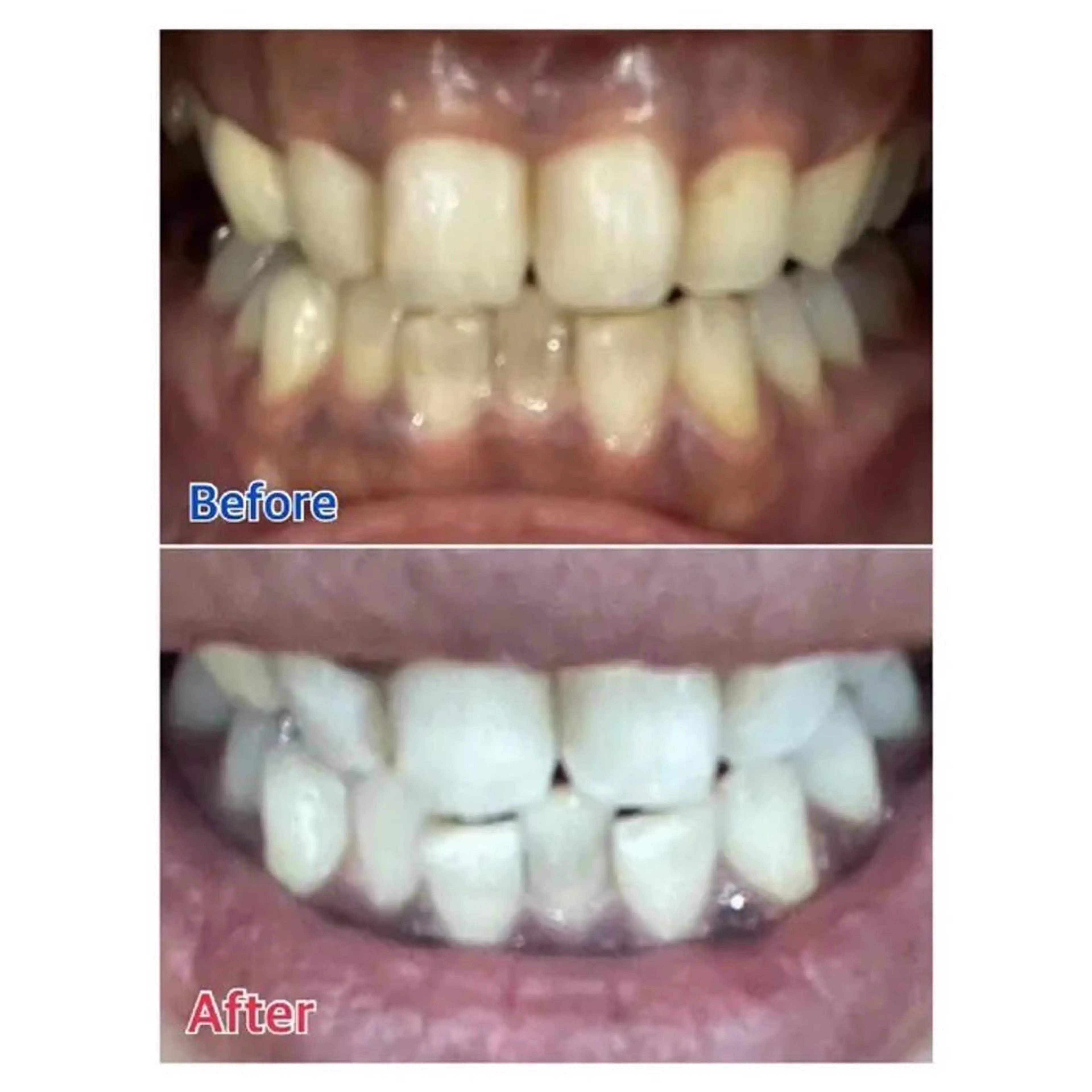 M渋谷 ホワイトニングのその他イメージ