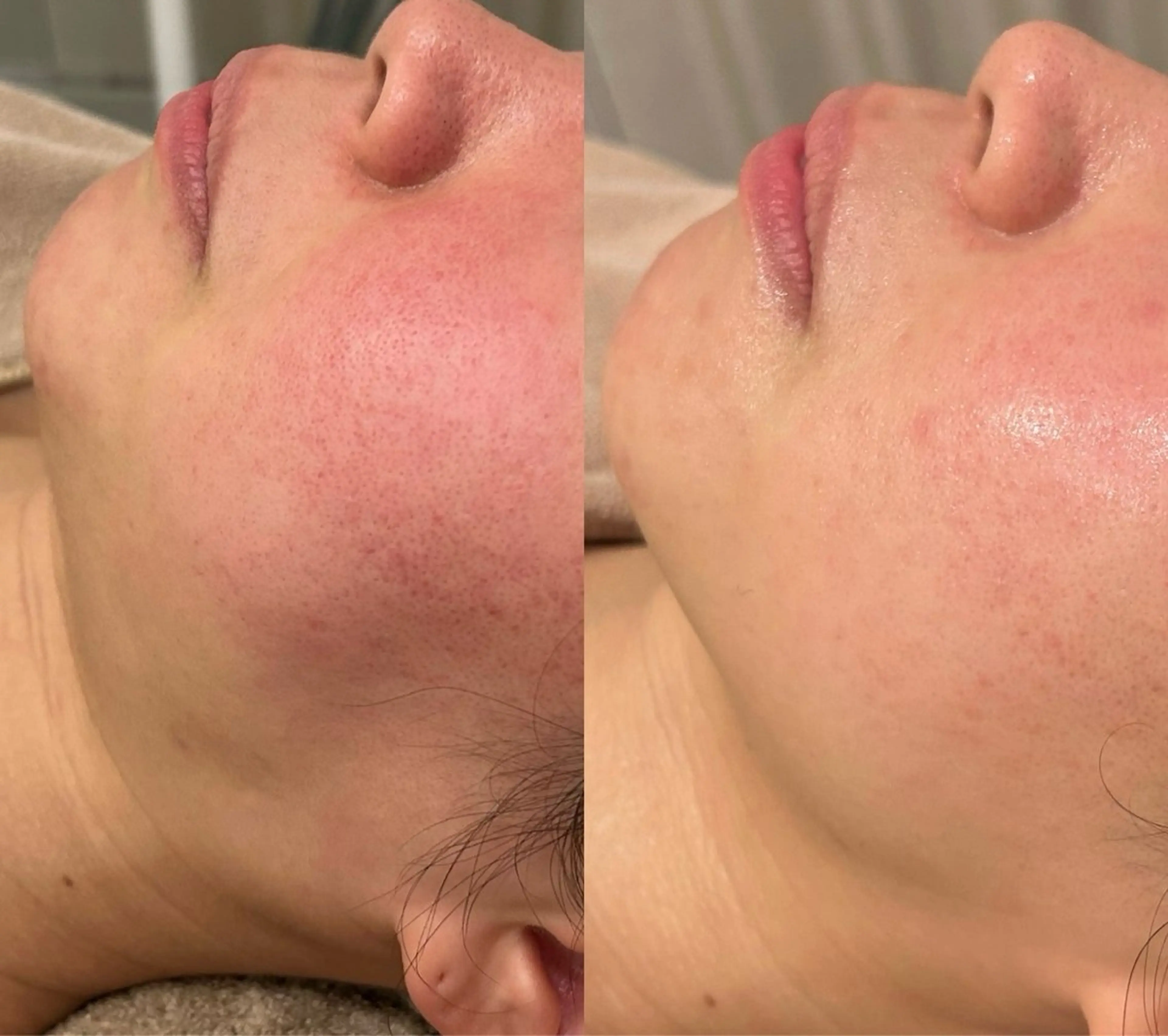 【都度払い脱毛】毛穴 専門サロン  馬車道のエステ・リラクイメージ