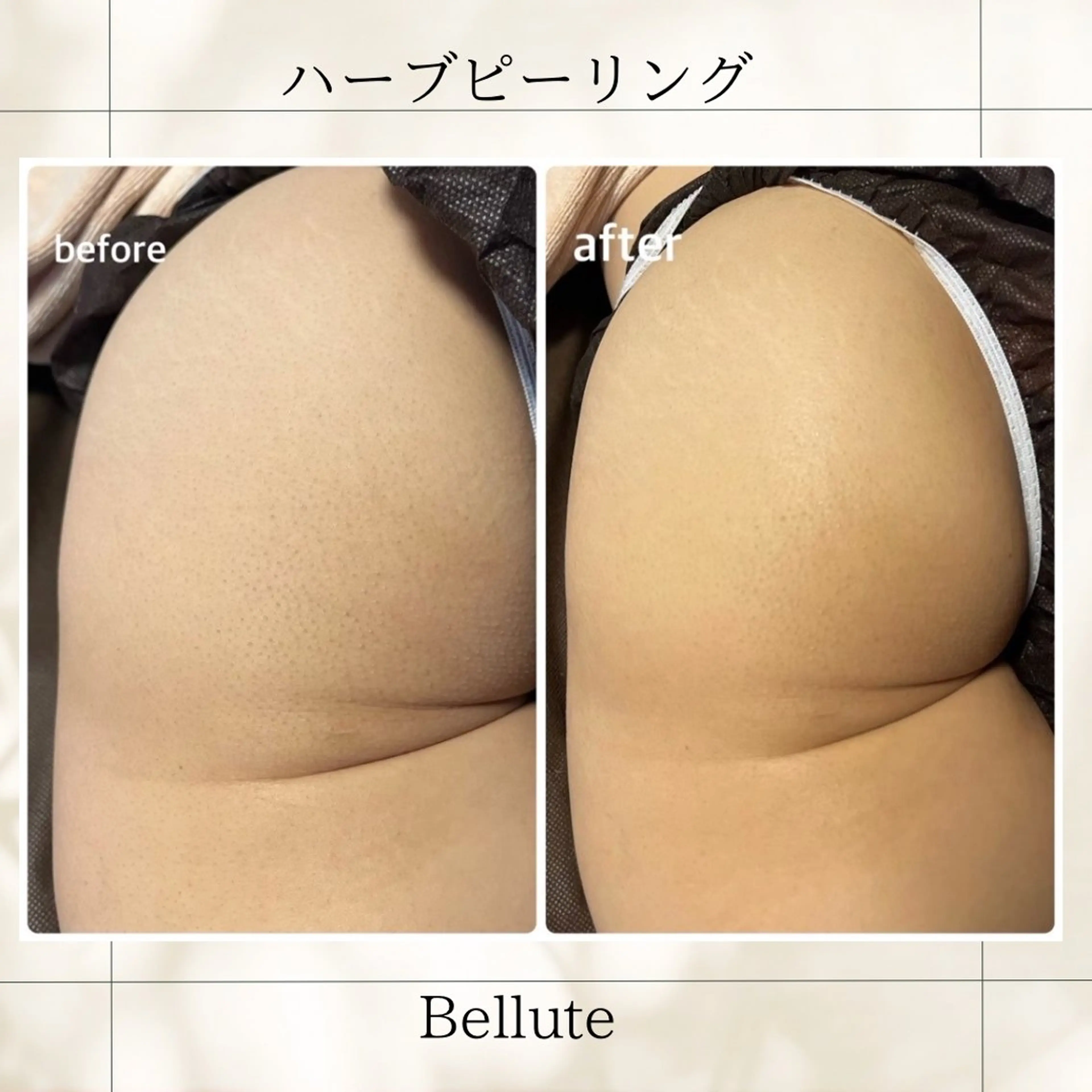 エステ ピーリング専門店 Belluteのエステ・リラクイメージ