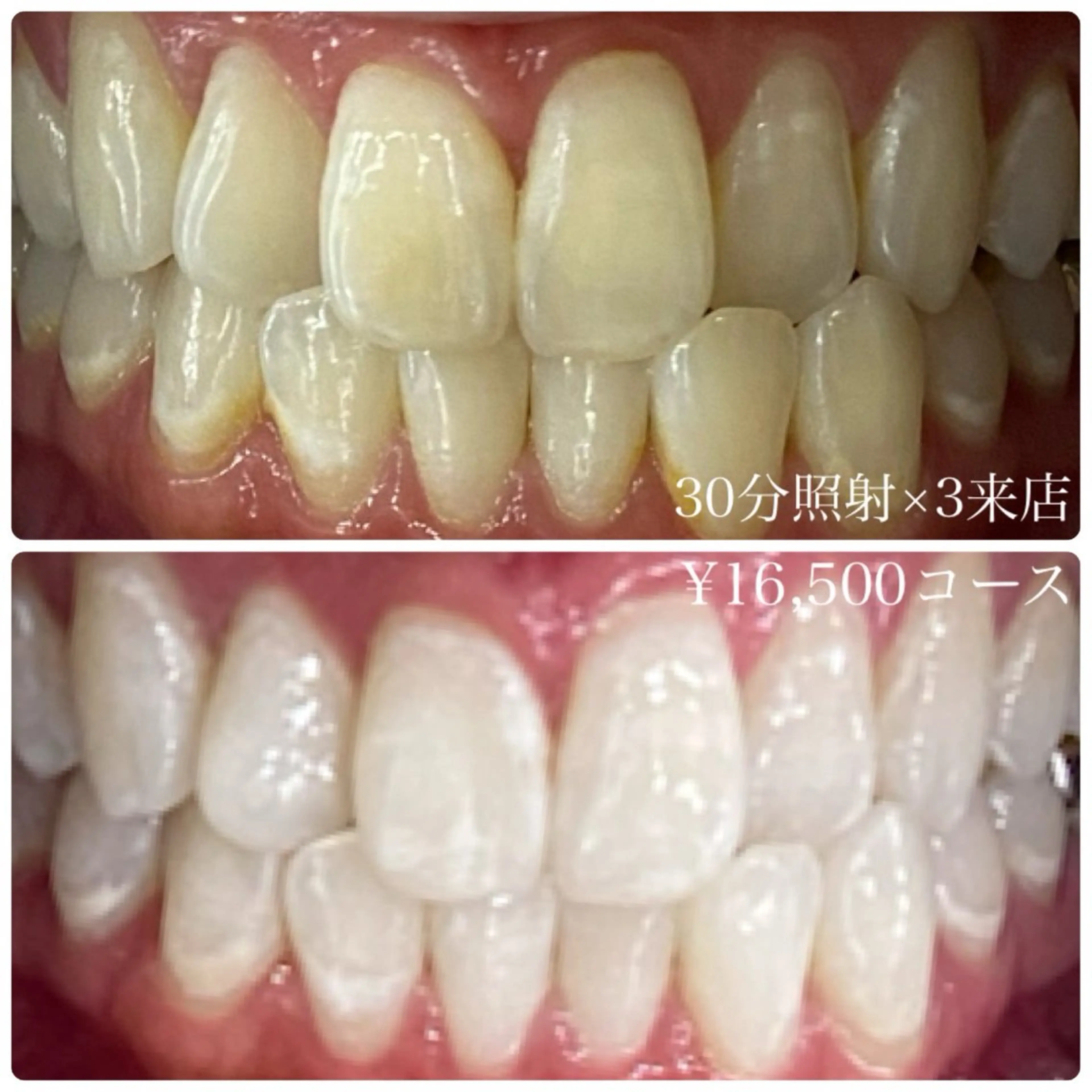 その他 ホワイトニングルーム 横浜店のその他イメージ