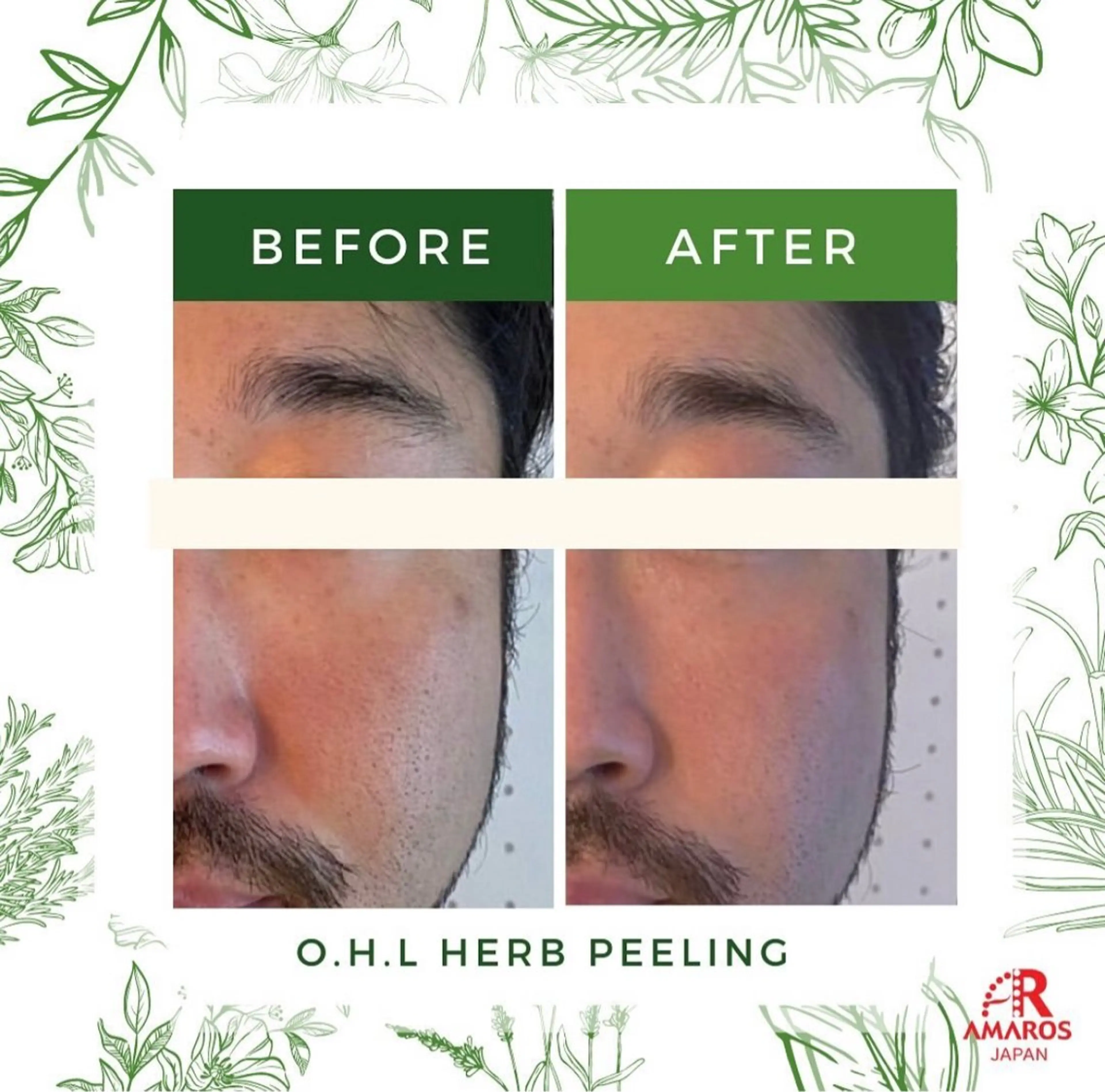 メンズ アイブロウサロンMily所属・眉毛/美肌の専門店 Mily🍒ミウィの眉毛・アイブロウイメージ