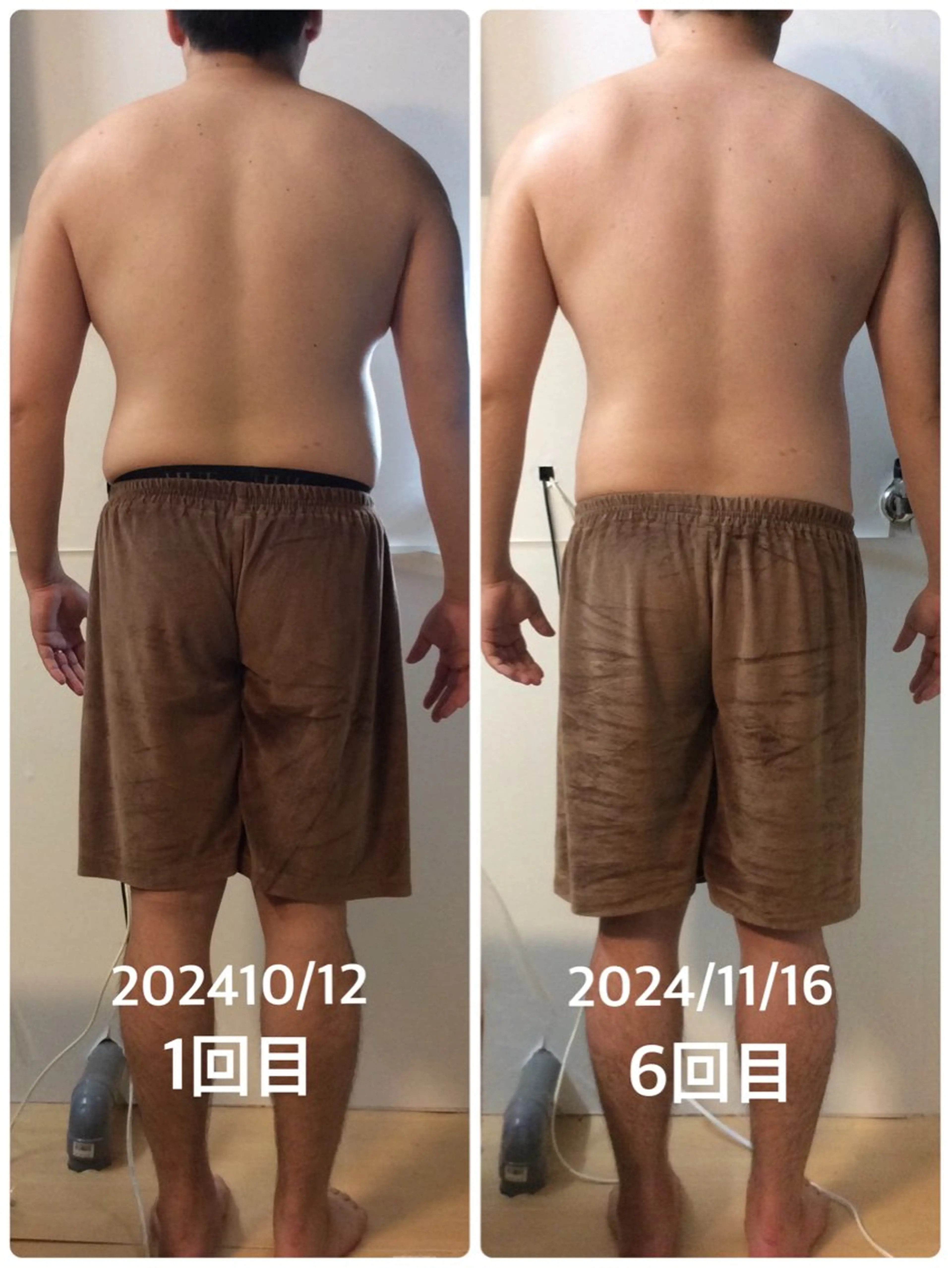 【men'sもOK】オールハンド痩身　背中＋二の腕60分の写真