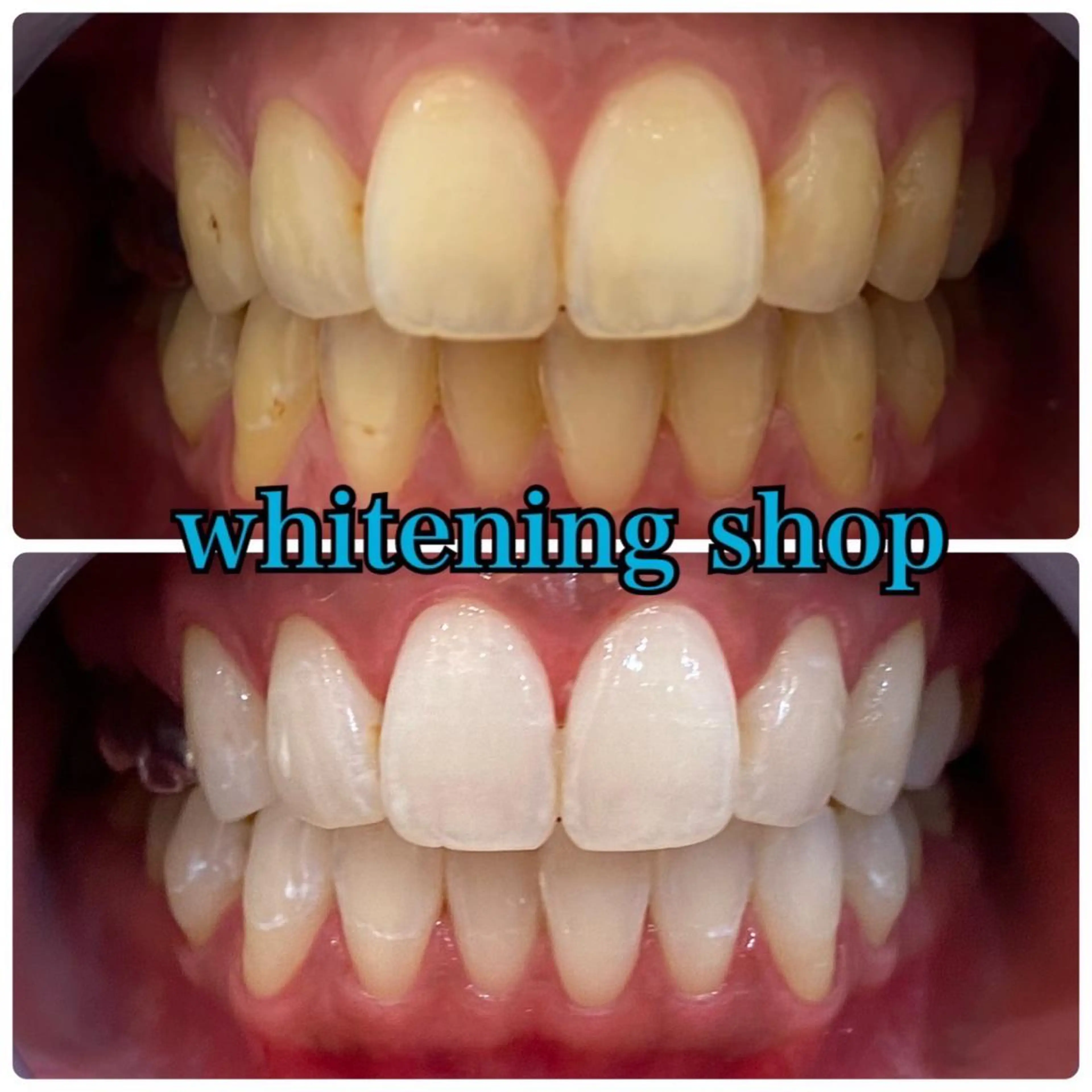 ホワイトニング ショップ千葉店のその他イメージ