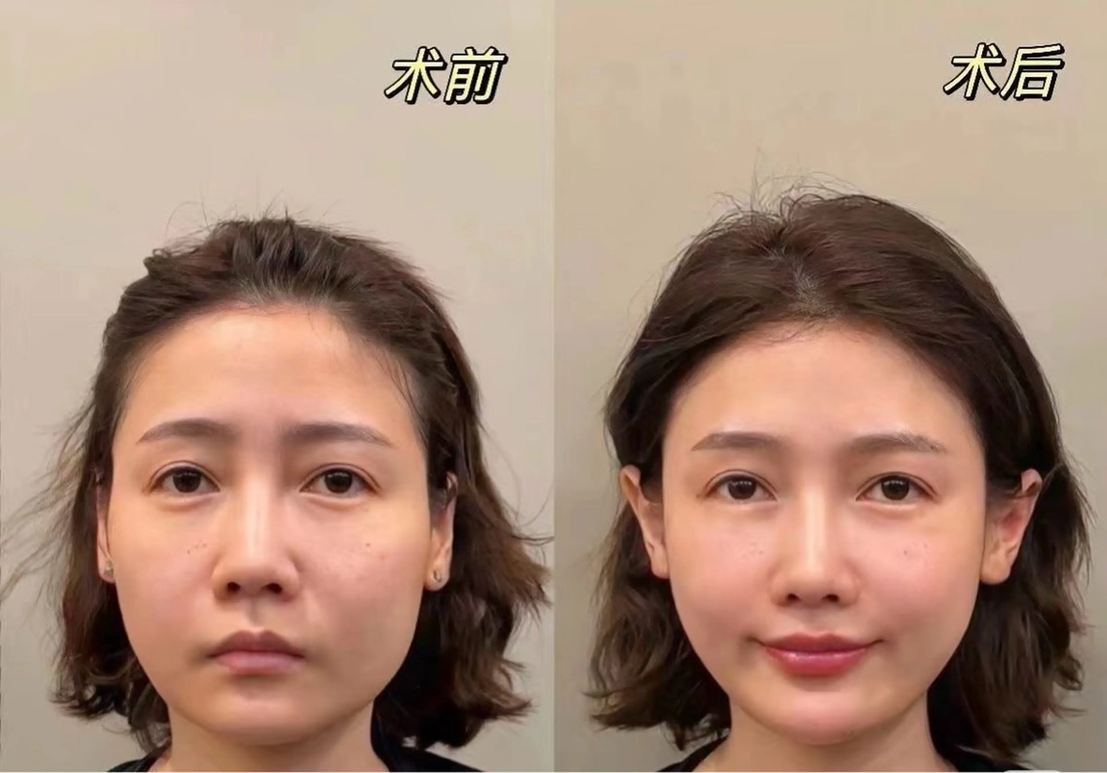 マツエク・マツパ エステ aliaハーブ水光店 エステティシャン募集のエステ・リラクイメージ