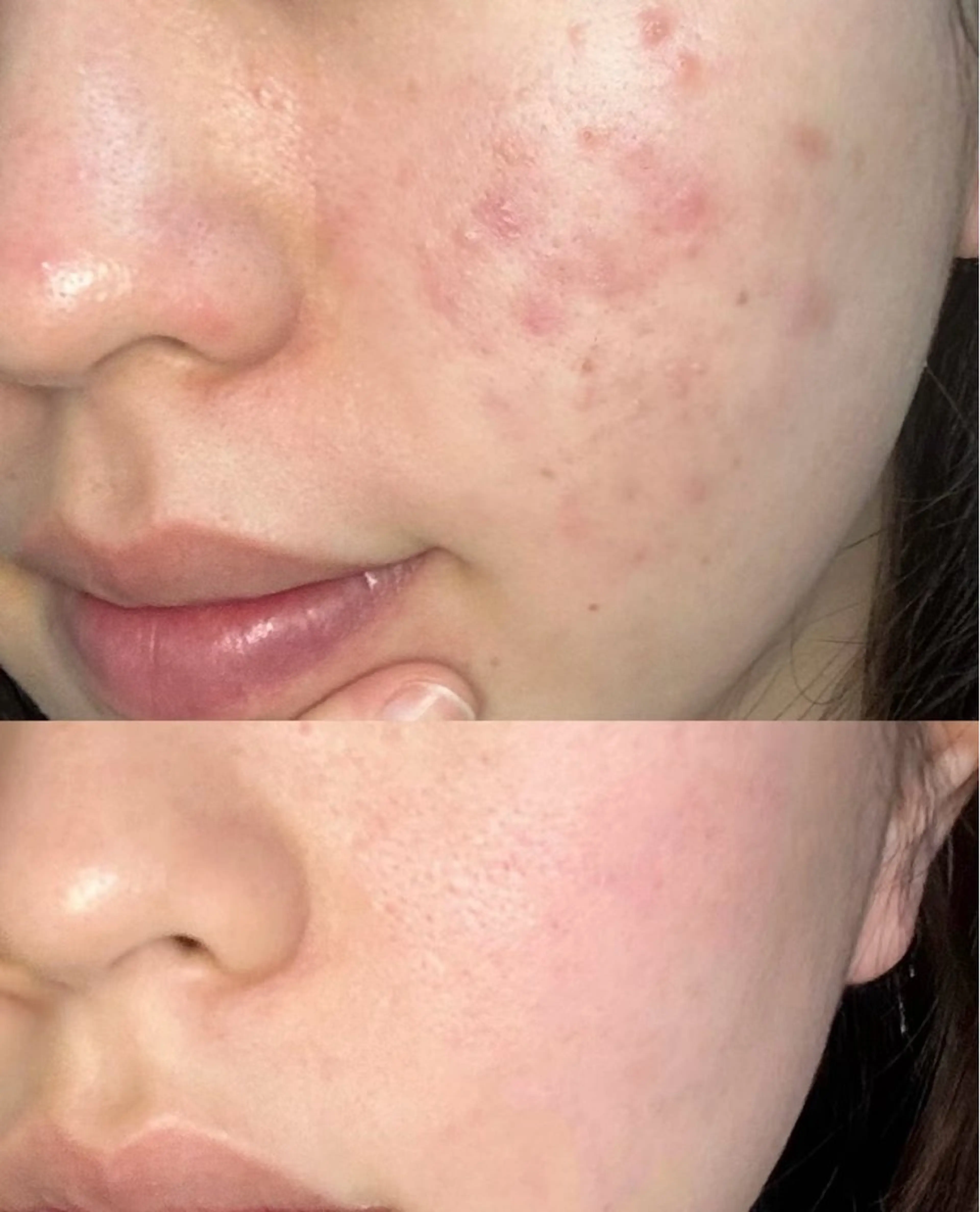 エステ リラク 愛維美水光美肌専門店 メンズレディースokのエステ・リラクイメージ