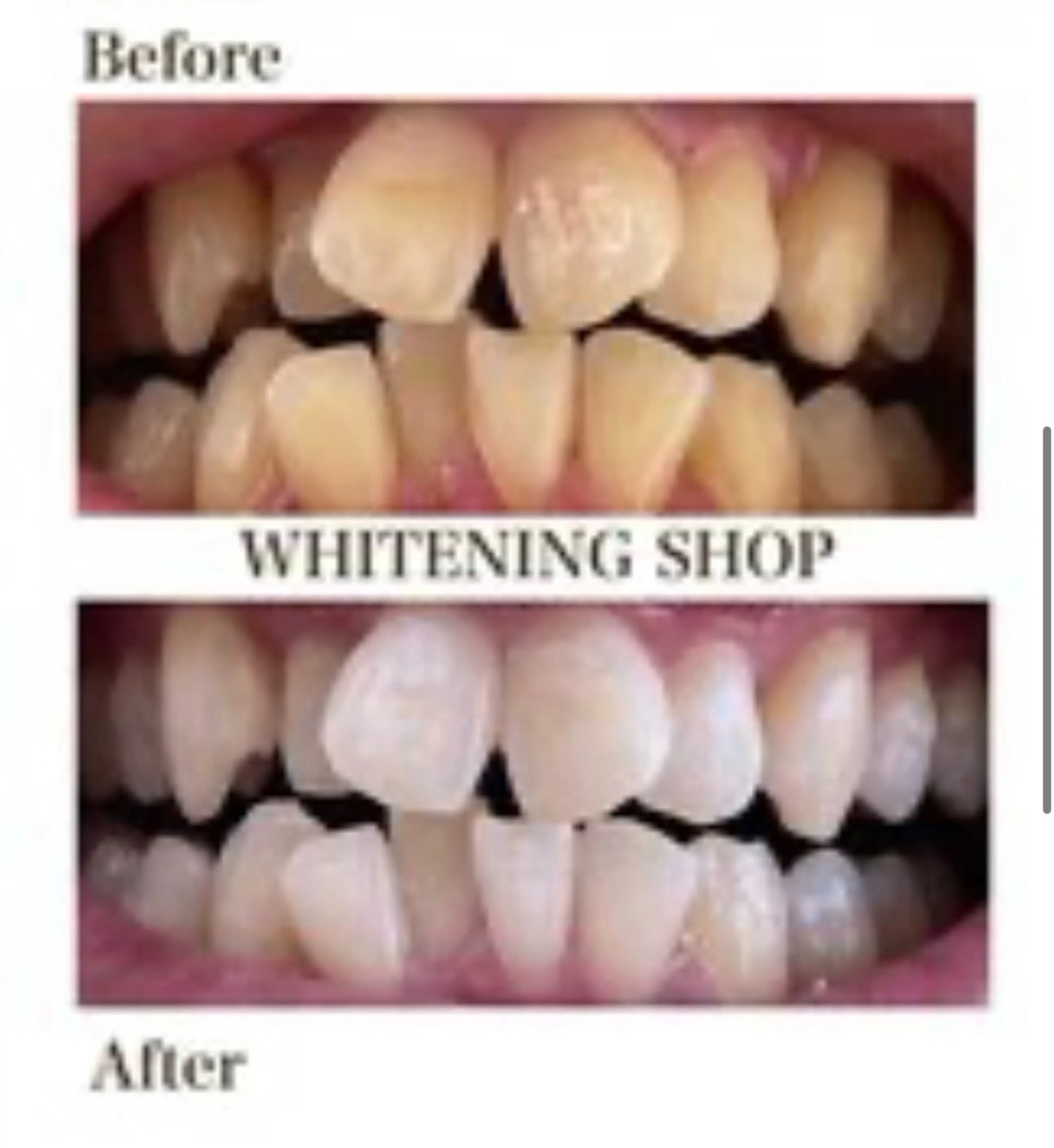 その他 ホワイトニングショップ津店所属・ホワイトニング ショップ津店のその他イメージ