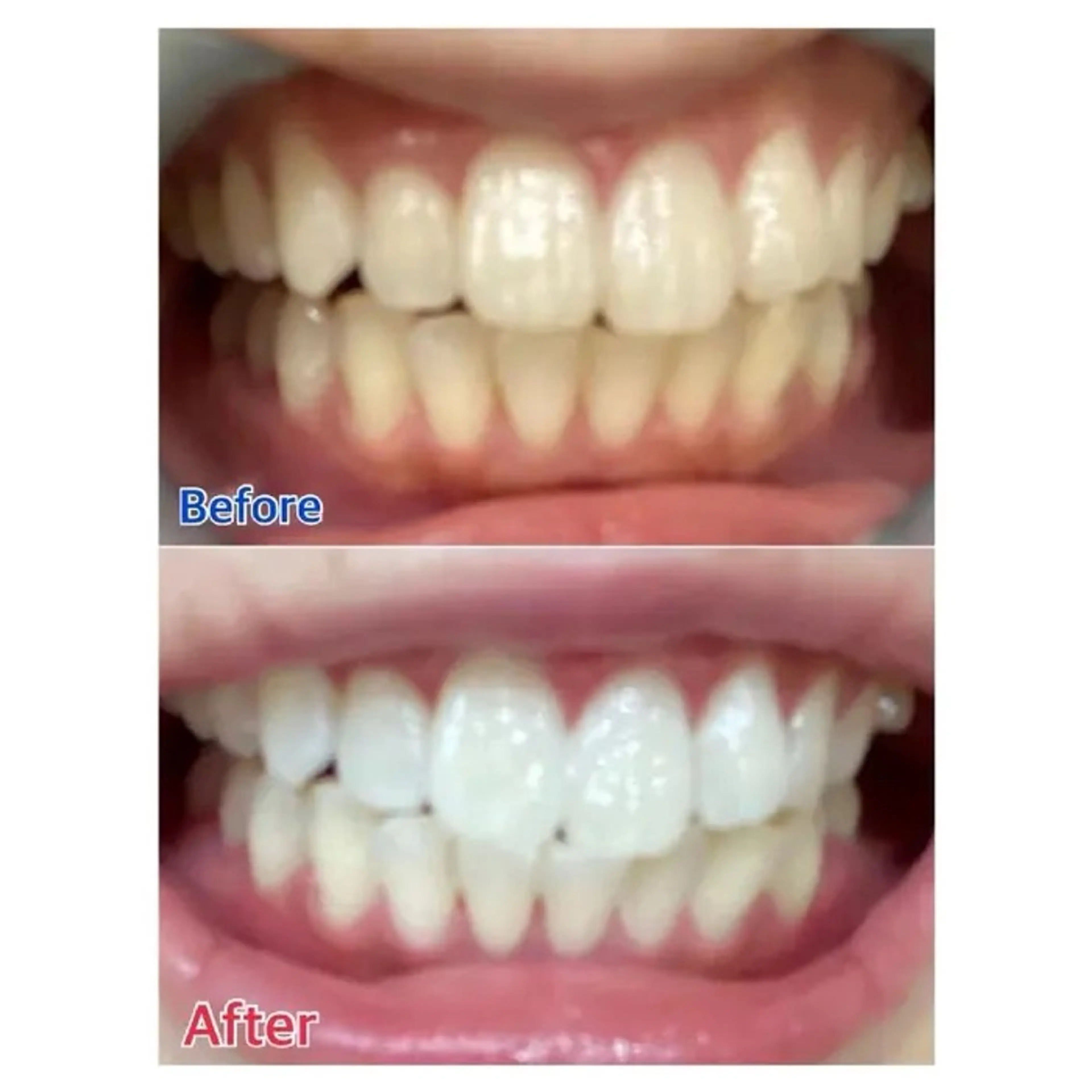 キッズ M渋谷 ホワイトニングのエステ・リラクイメージ