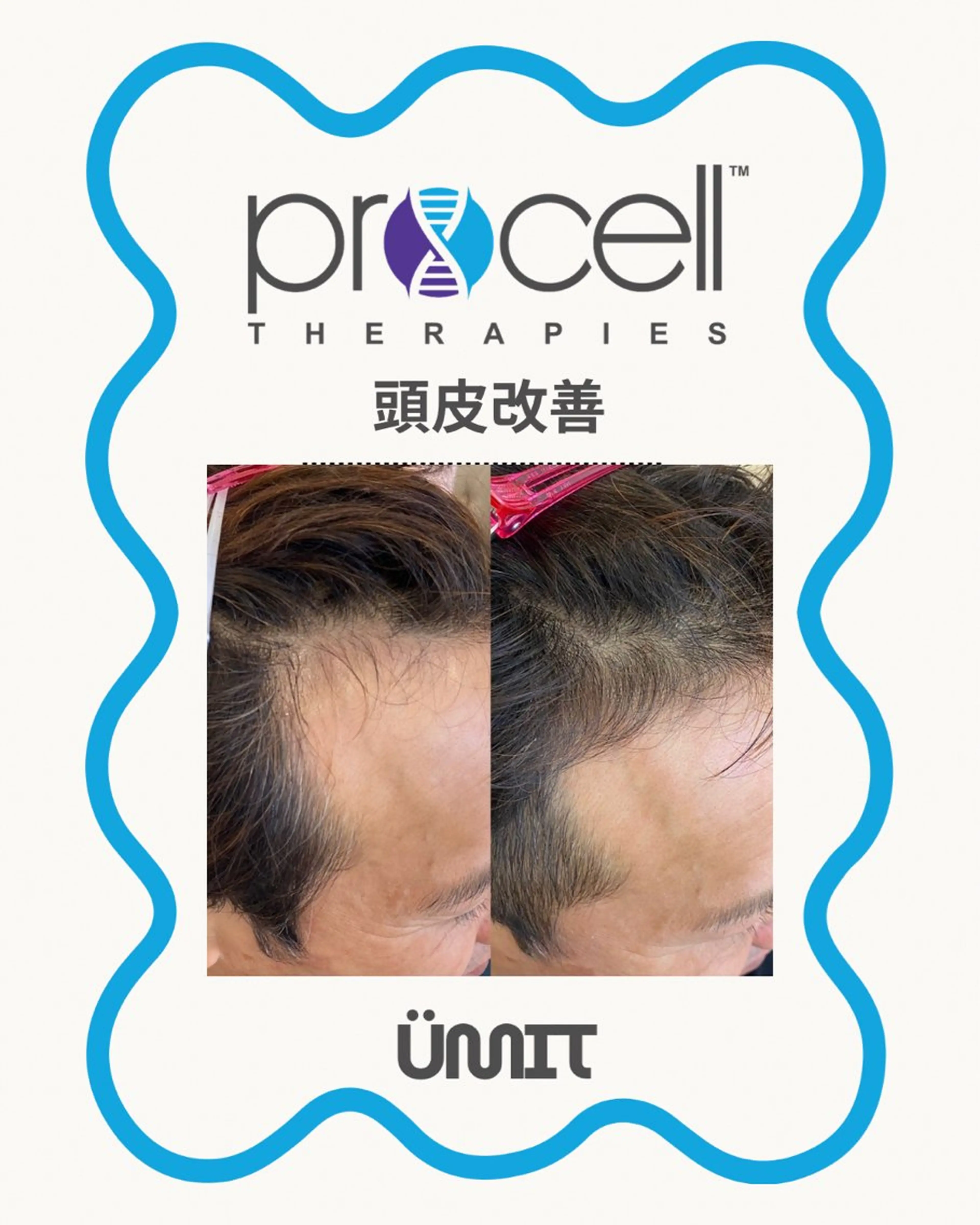 メンズ ヘッドスパ Ümit（ユミト） プロセルセラピーズのネイルデザイン