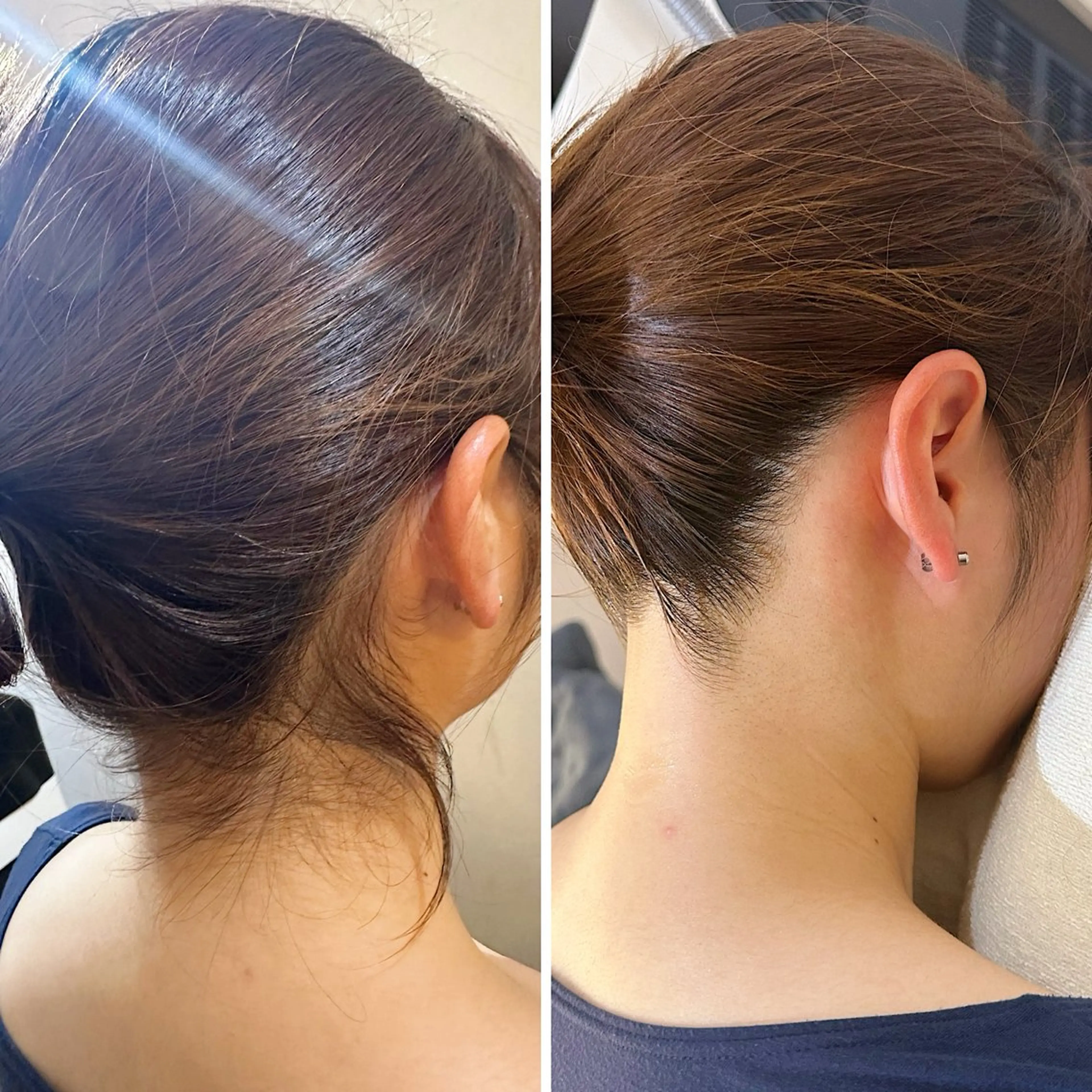 脱毛 うなじ脱毛/美肌脱毛 LABELのエステ・リラクイメージ