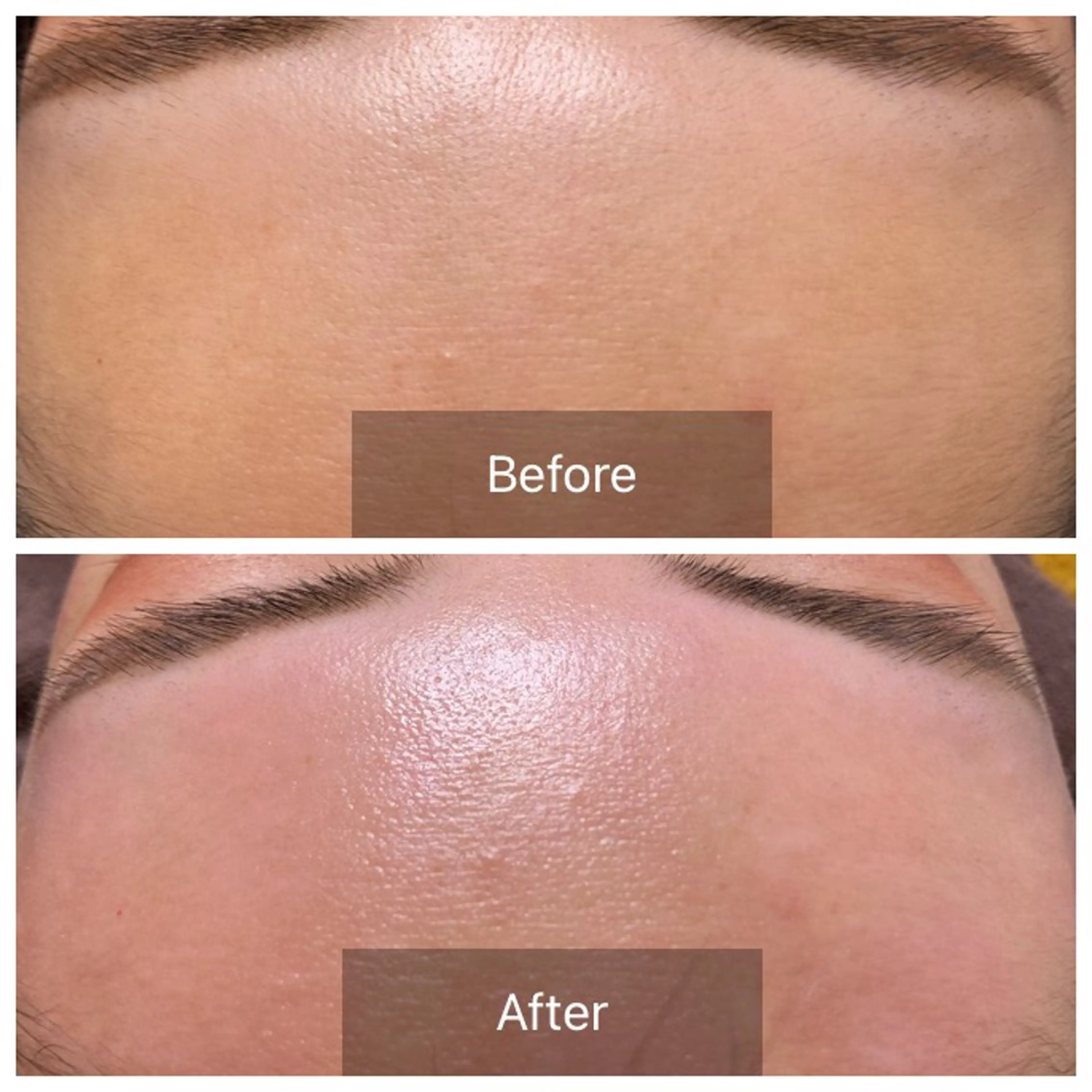 エステ 産毛専門店 Bittoのエステ・リラクイメージ