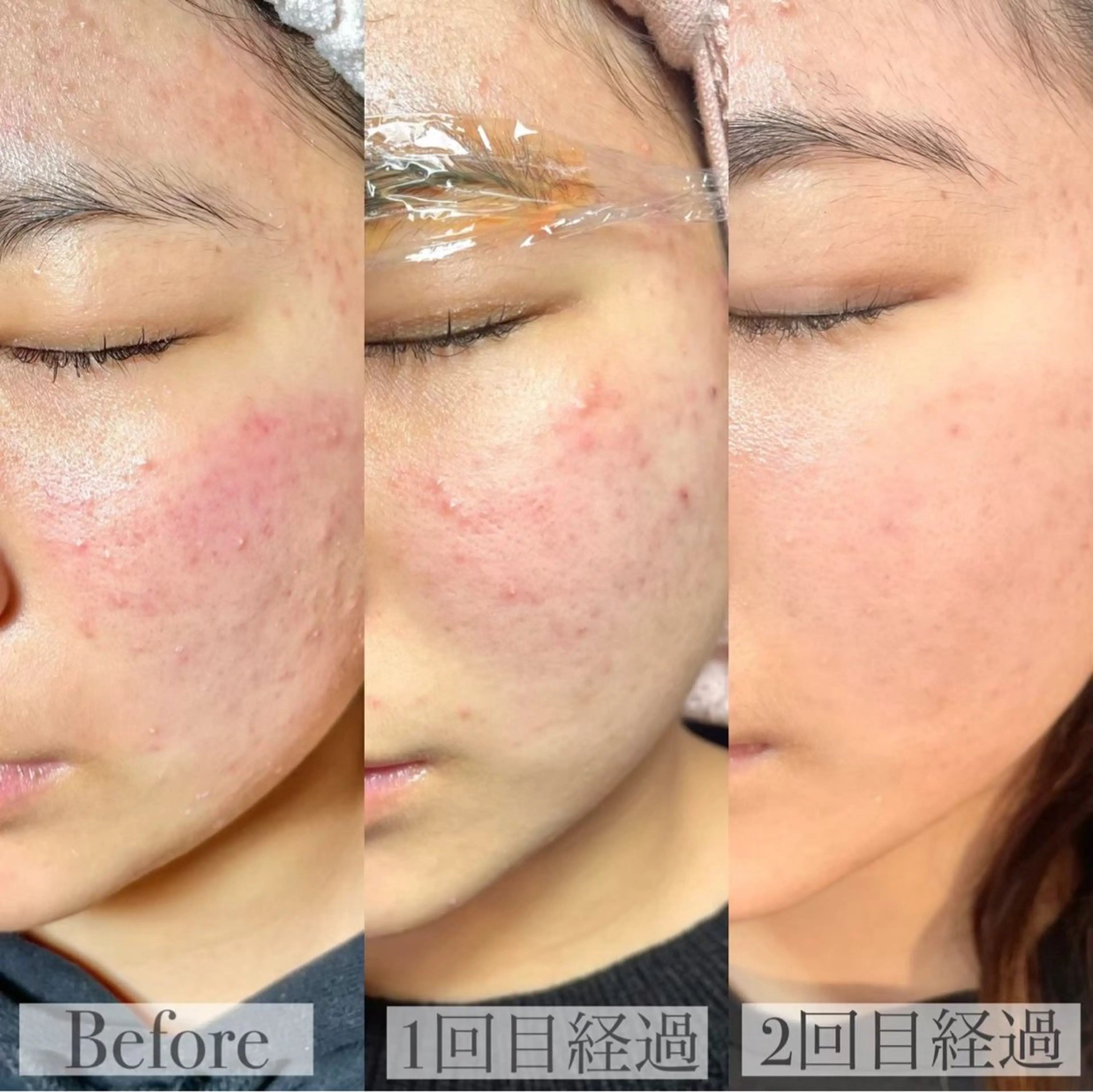 LUVRE龍田 MIKIまつ毛/眉毛の眉毛・アイブロウイメージ