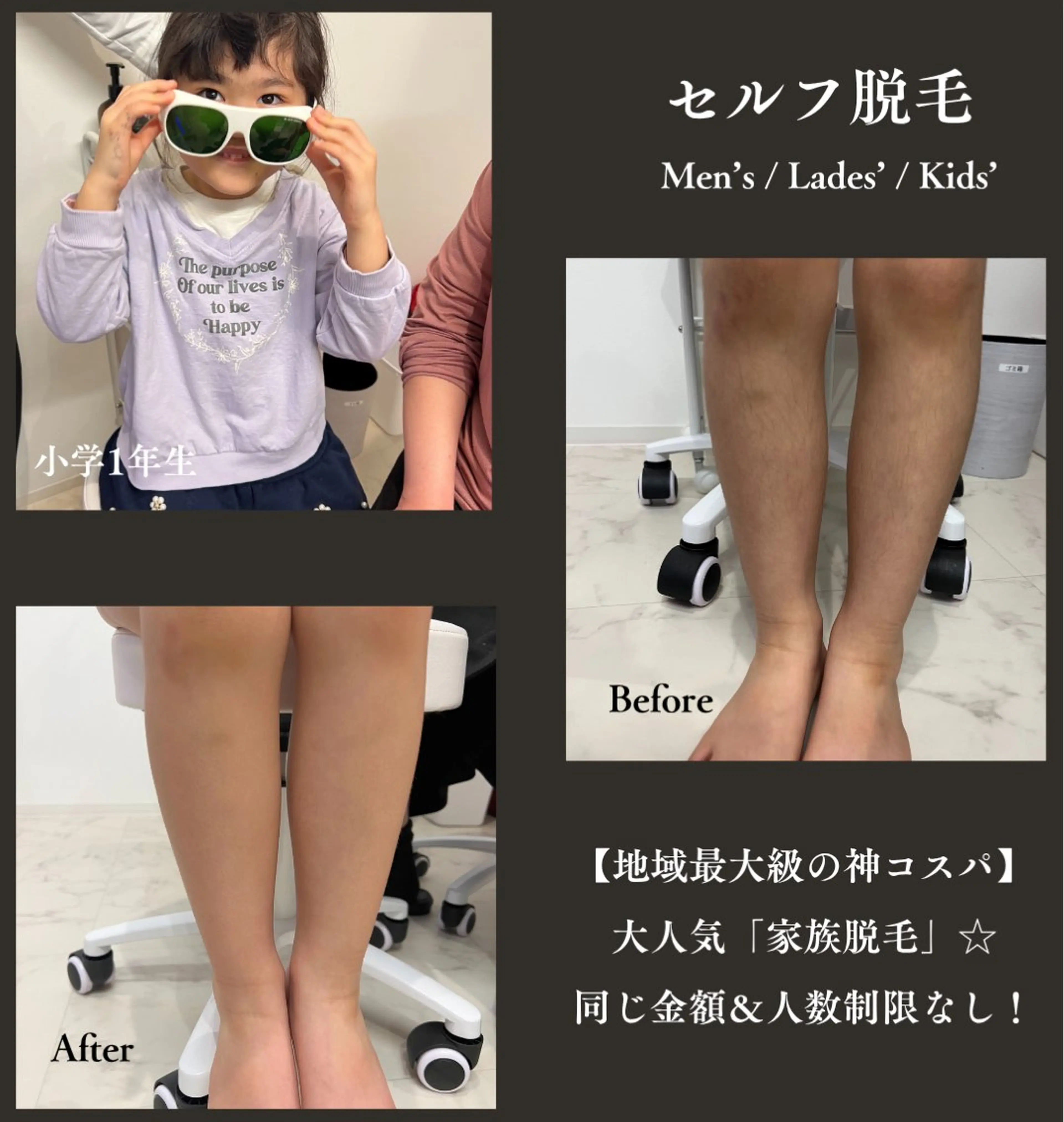 メンズ キッズ 脱毛 Coco Bloom ココブルームのエステ・リラクイメージ