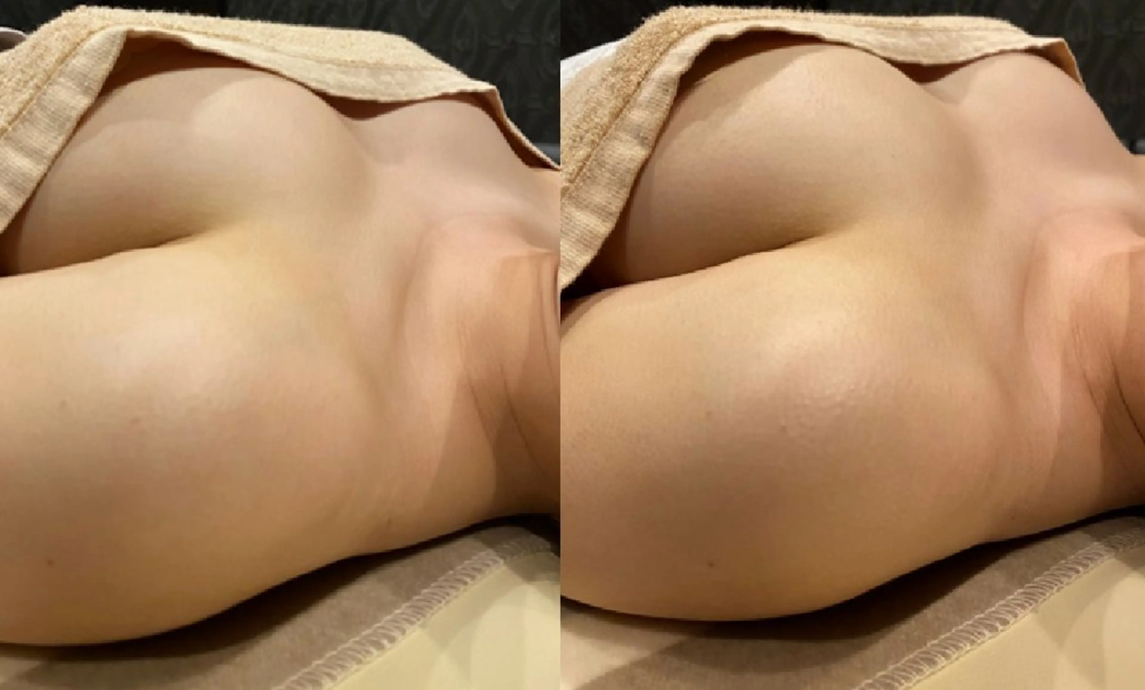 NRプレミアムバスト《全身筋膜コース》　諦めていたバストアップを叶えるの写真