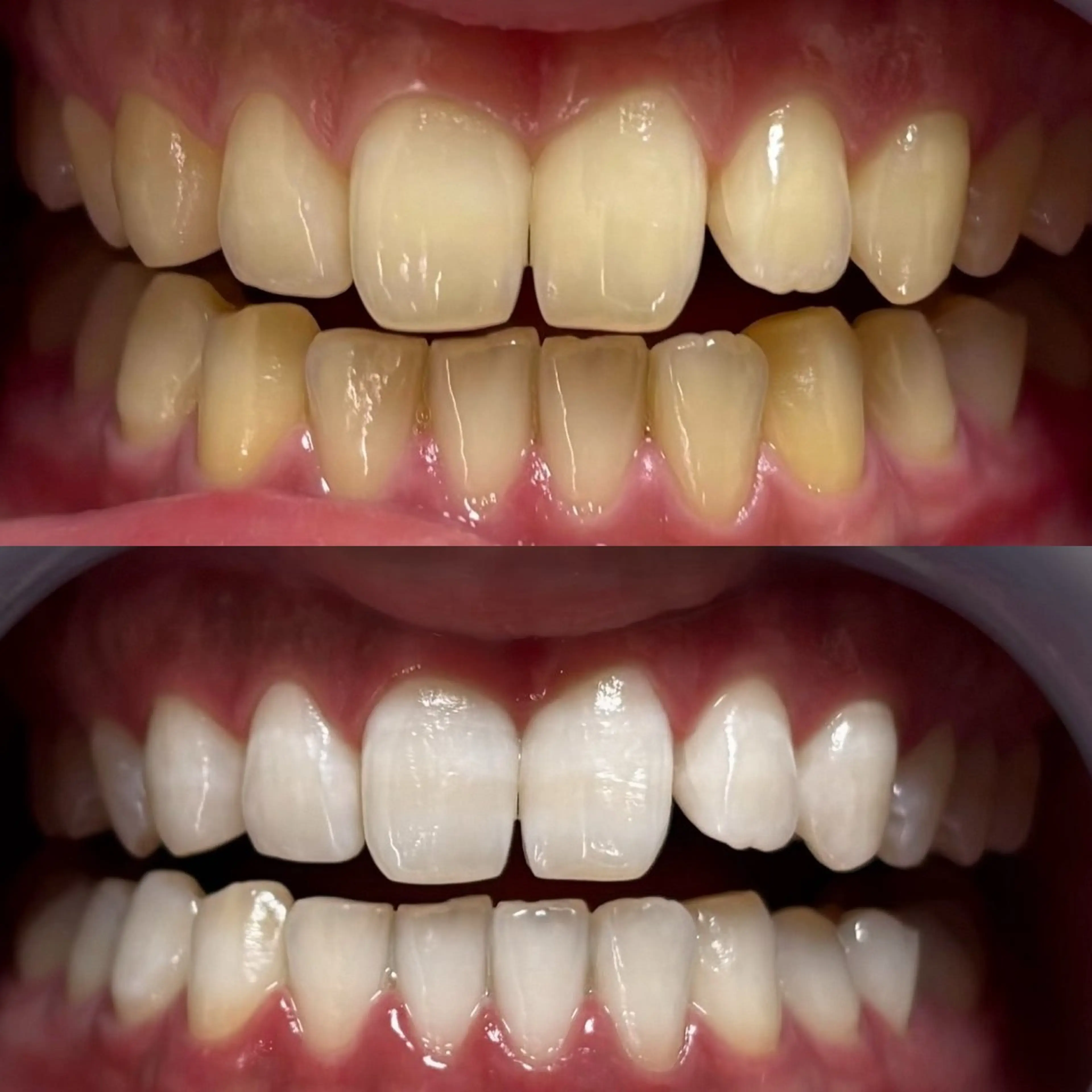 その他 LOVE ホワイトニング新宿店のその他イメージ